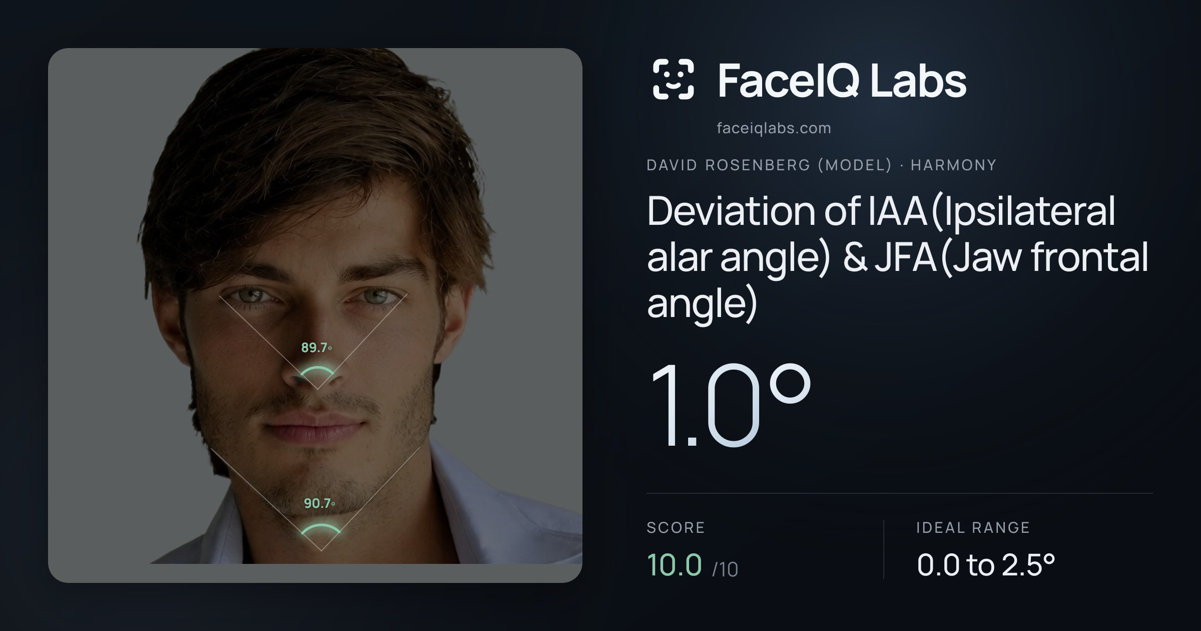 David Rosenberg (Model) Deviation of IAA(Ipsilateral alar angle) & JFA(Jaw frontal angle): 1.0°, drawn on the photo