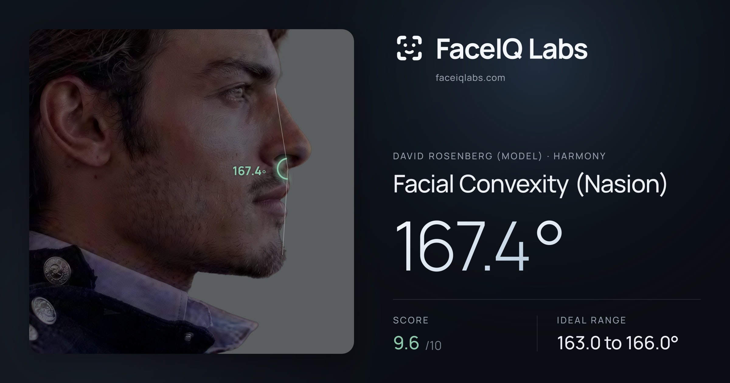 David Rosenberg (Model) Facial Convexity (Nasion): 167.4°, drawn on the photo