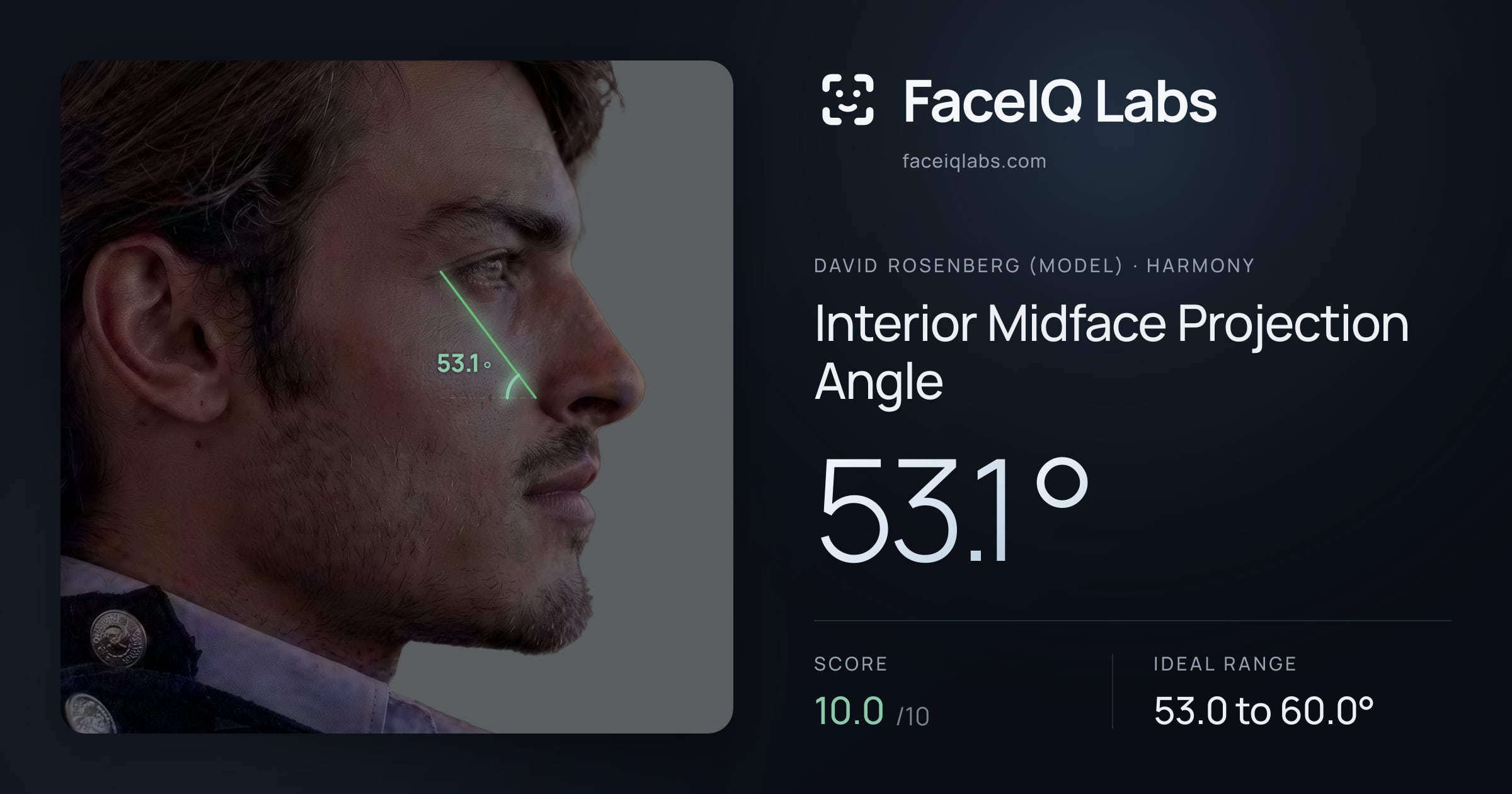 David Rosenberg (Model) Interior Midface Projection Angle: 53.1°, drawn on the photo