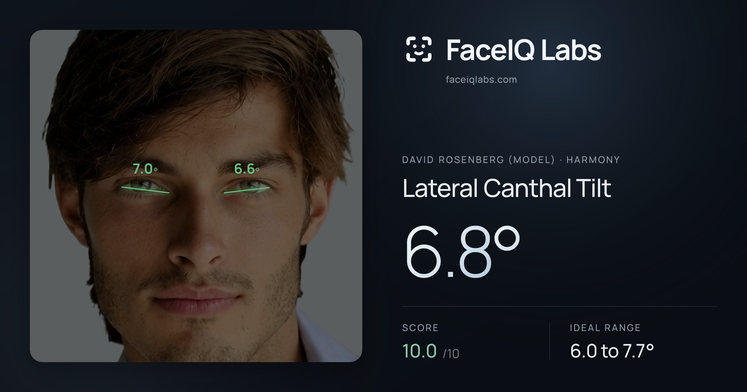 David Rosenberg (Model) Lateral Canthal Tilt: 6.8°, drawn on the photo