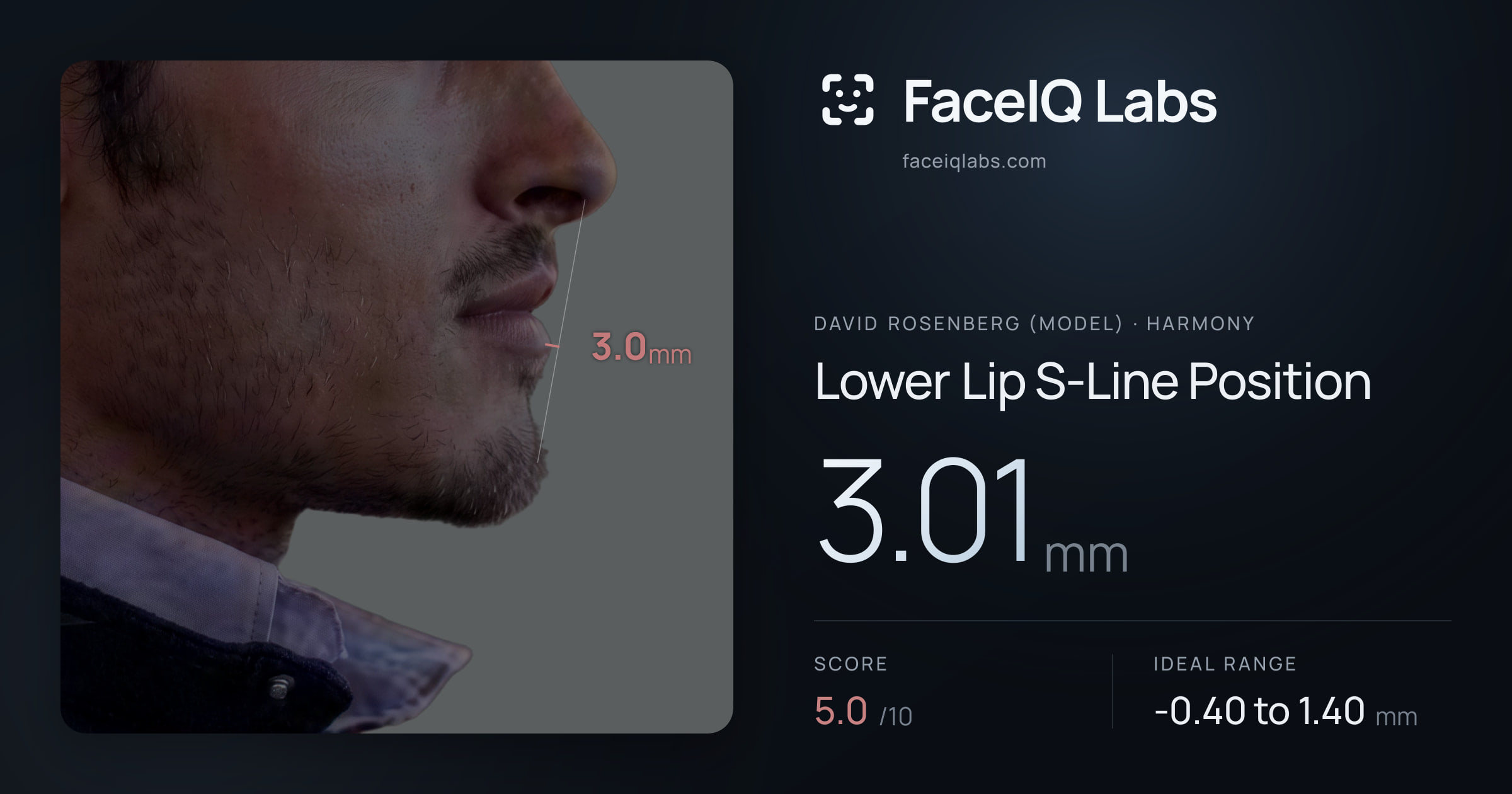 David Rosenberg (Model) Lower Lip S-Line Position: 3.01mm, drawn on the photo