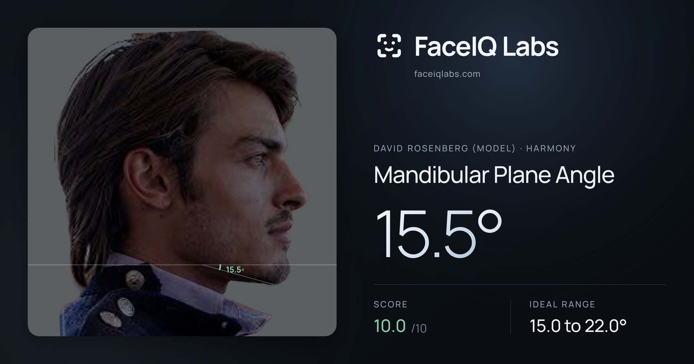 David Rosenberg (Model) Mandibular Plane Angle: 15.5°, drawn on the photo