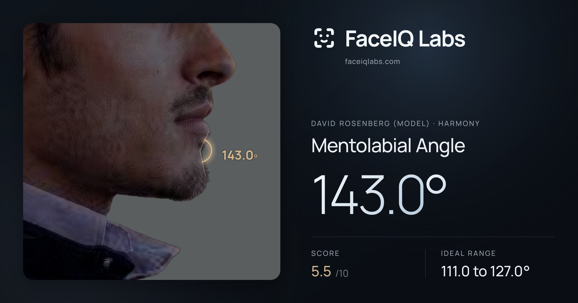 David Rosenberg (Model) Mentolabial Angle: 143.0°, drawn on the photo