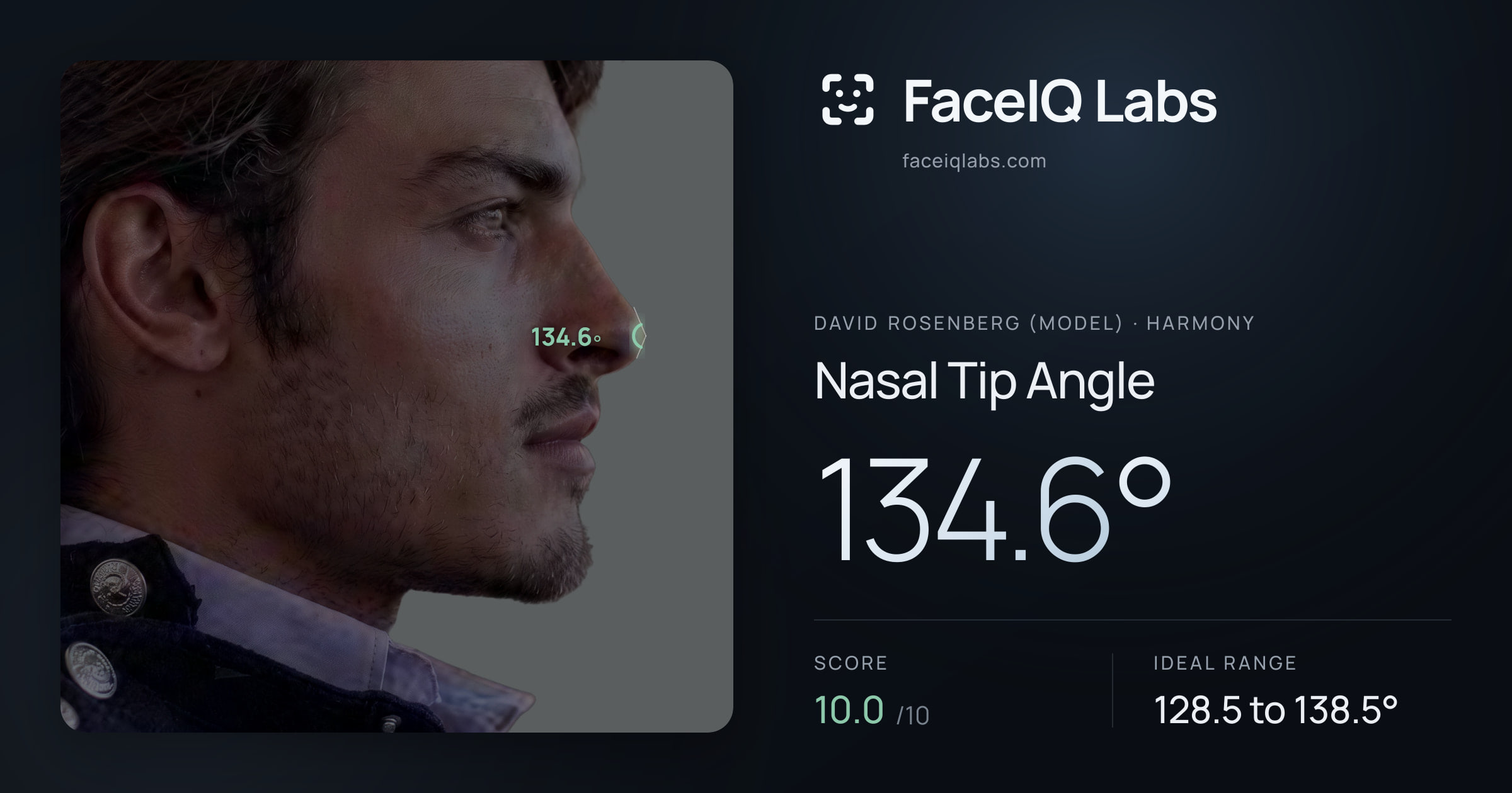 David Rosenberg (Model) Nasal Tip Angle: 134.6°, drawn on the photo