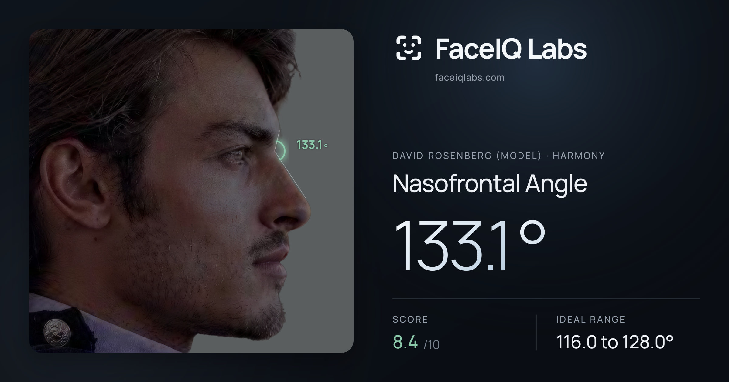 David Rosenberg (Model) Nasofrontal Angle: 133.1°, drawn on the photo