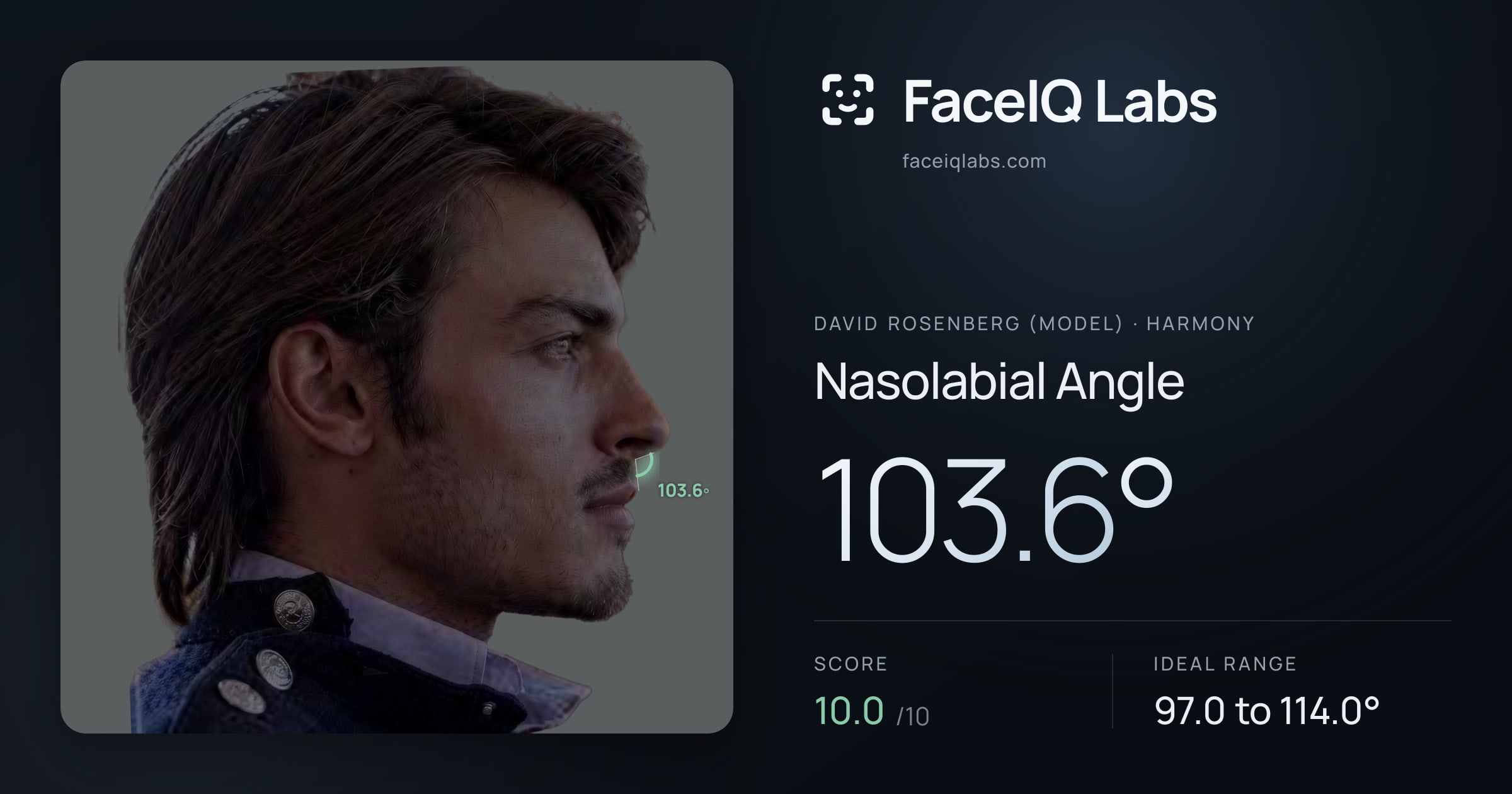 David Rosenberg (Model) Nasolabial Angle: 103.6°, drawn on the photo