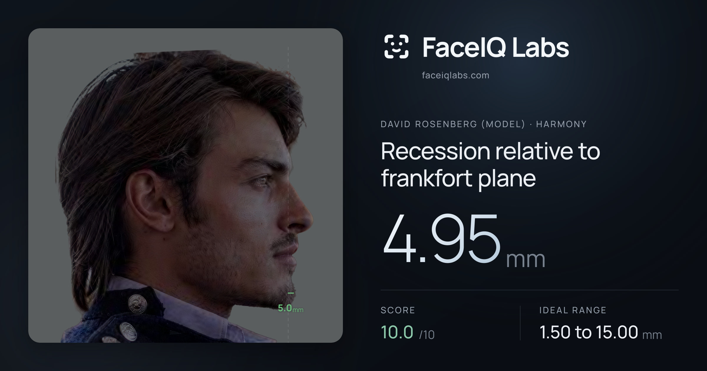 David Rosenberg (Model) Recession relative to frankfort plane: 4.95mm, drawn on the photo
