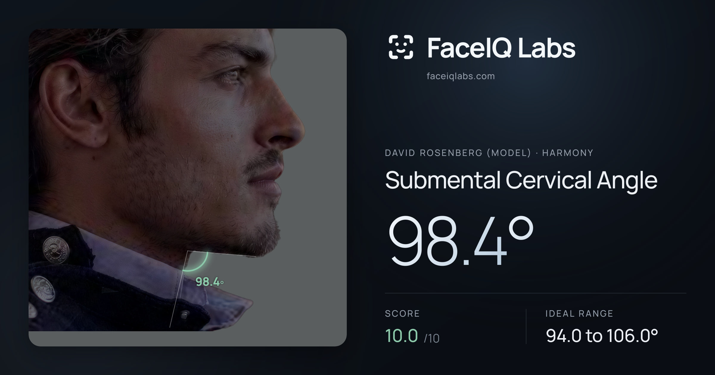 David Rosenberg (Model) Submental Cervical Angle: 98.4°, drawn on the photo