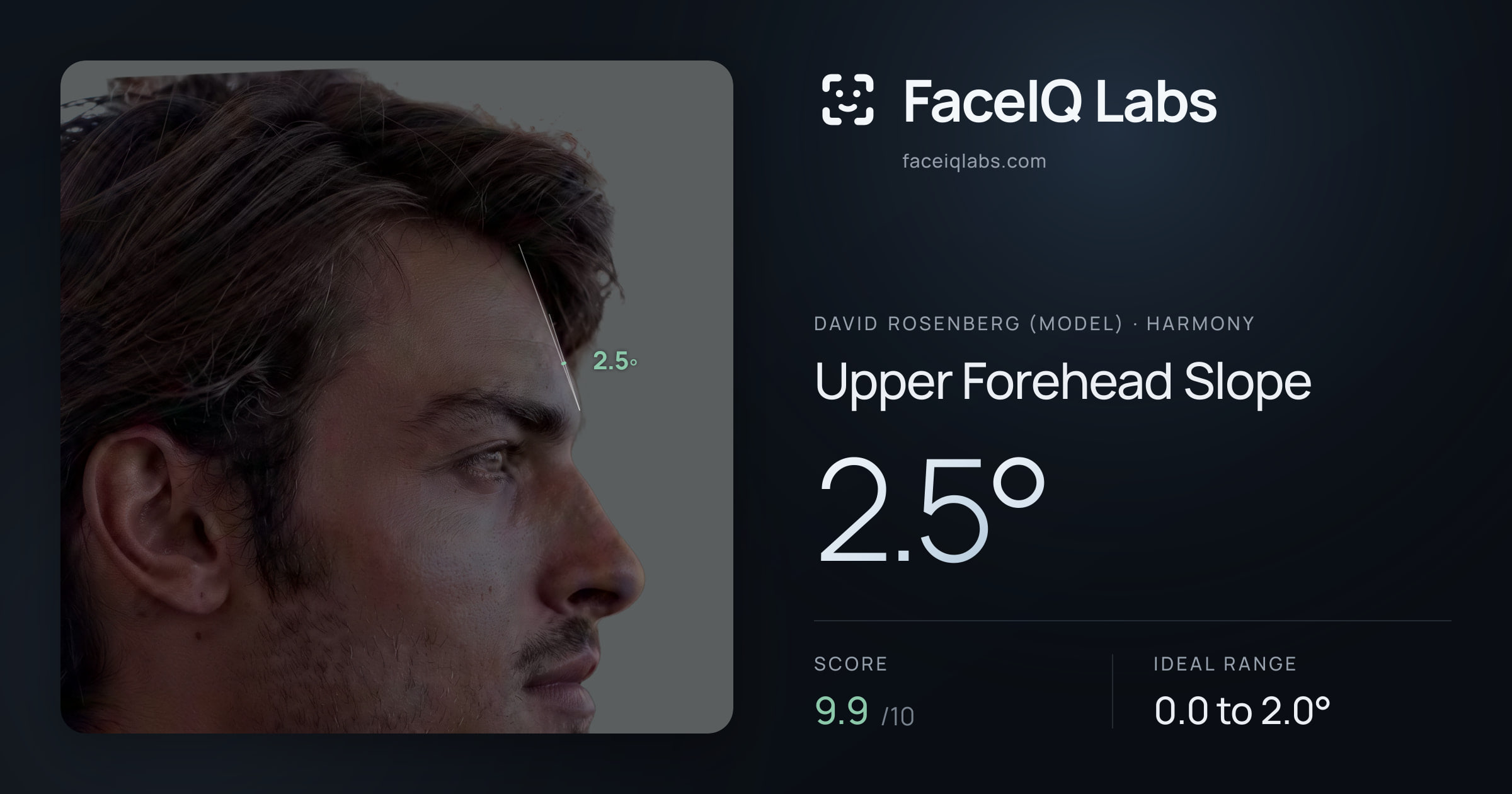 David Rosenberg (Model) Upper Forehead Slope: 2.5°, drawn on the photo