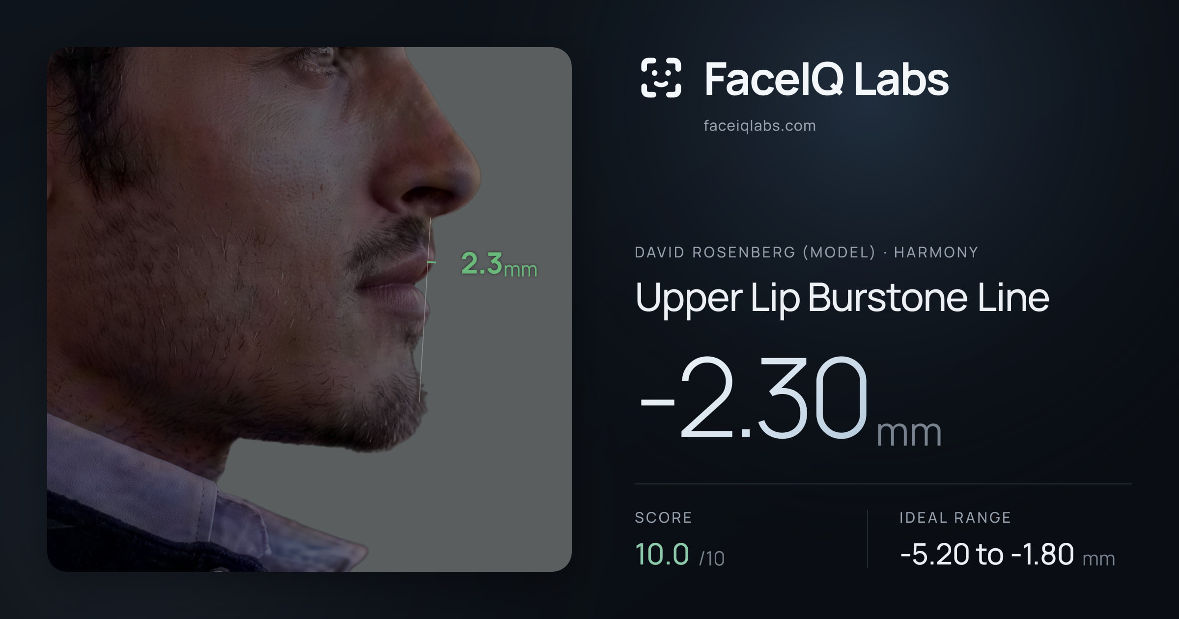 David Rosenberg (Model) Upper Lip Burstone Line: -2.30mm, drawn on the photo