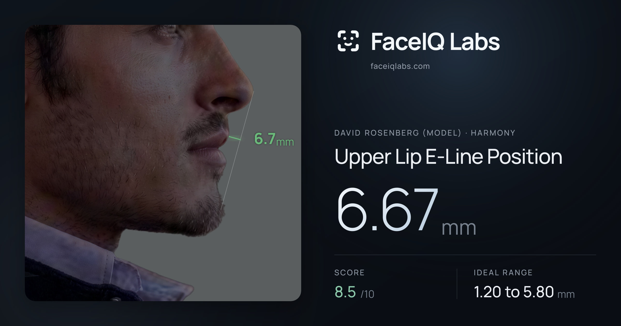David Rosenberg (Model) Upper Lip E-Line Position: 6.67mm, drawn on the photo