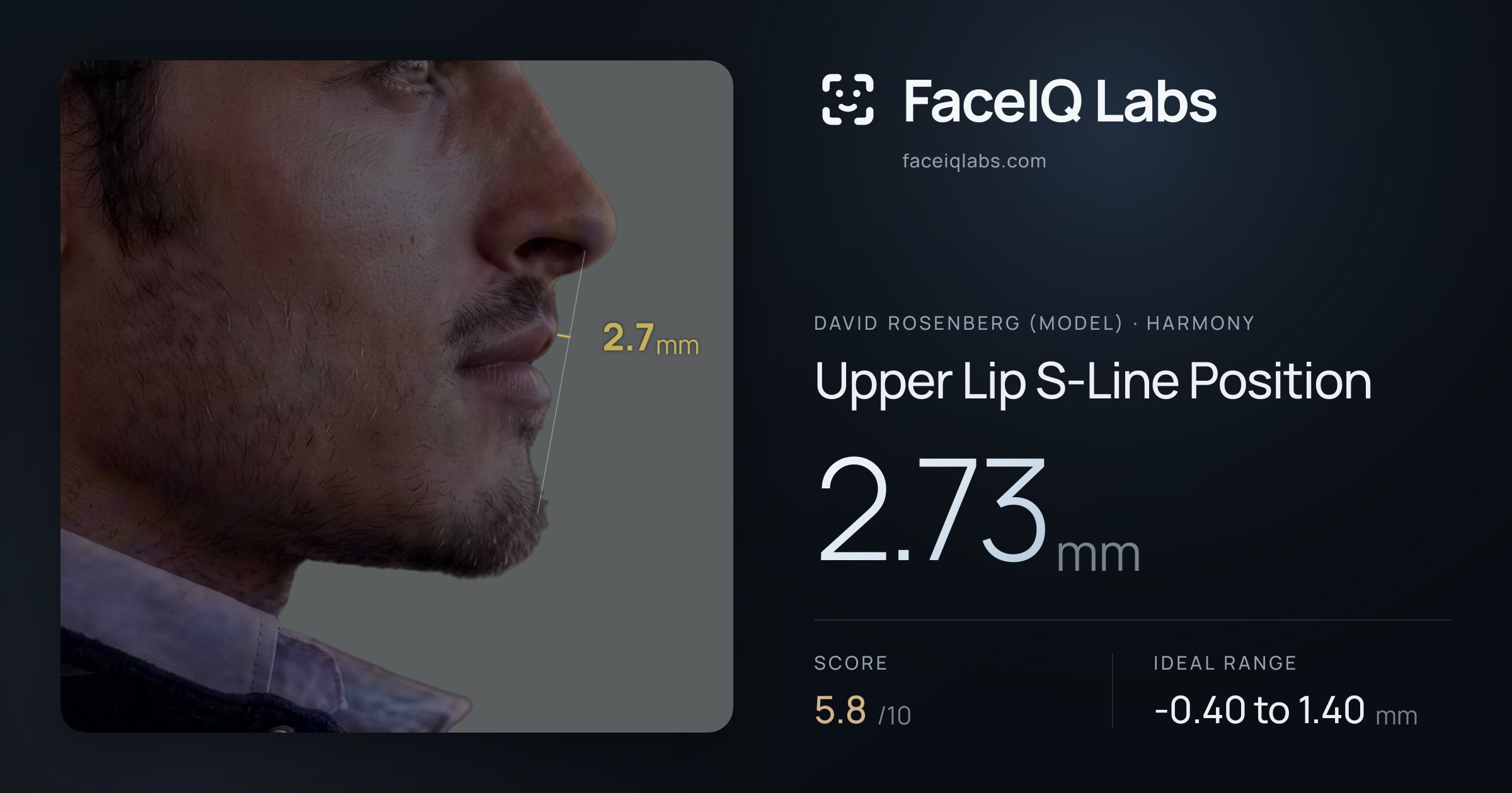 David Rosenberg (Model) Upper Lip S-Line Position: 2.73mm, drawn on the photo