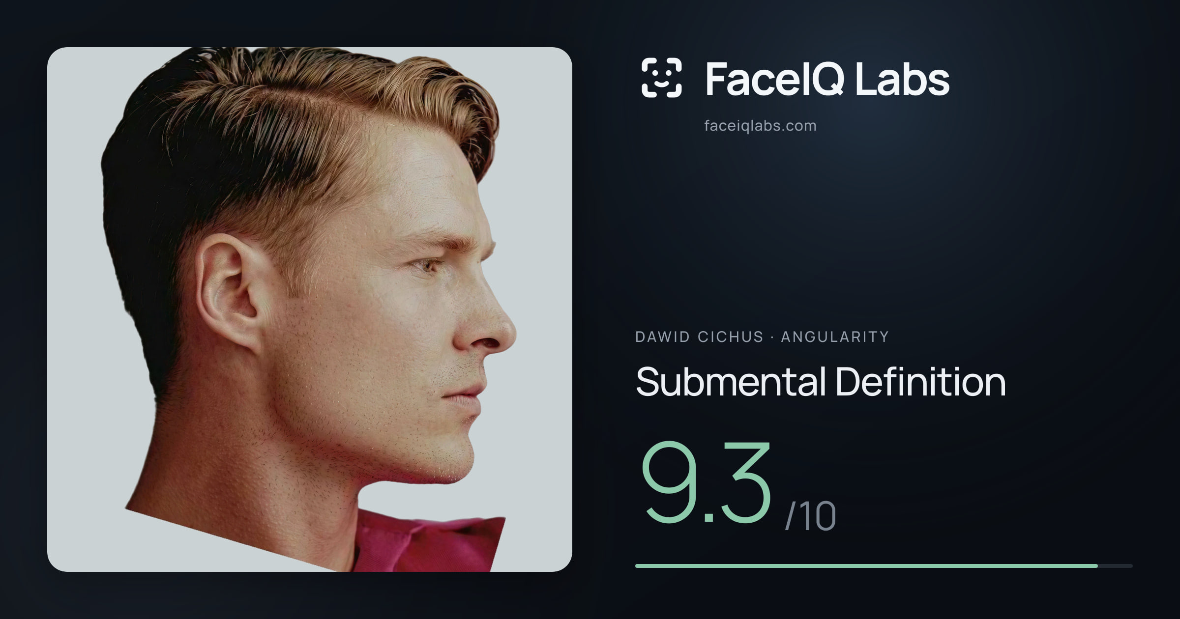 Dawid Cichus Submental Definition: 9.3/10, drawn on the photo