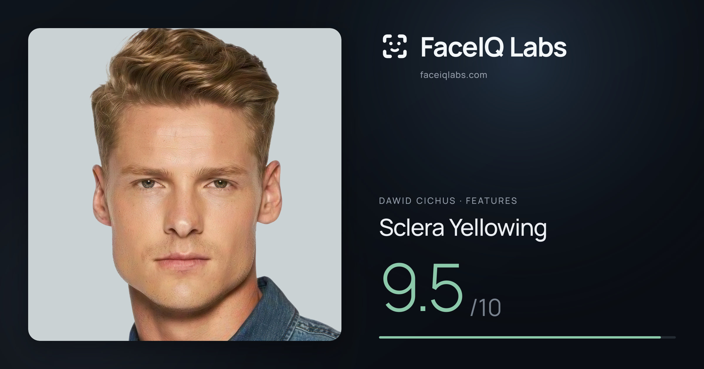 Dawid Cichus Sclera Yellowing: 9.5/10, drawn on the photo