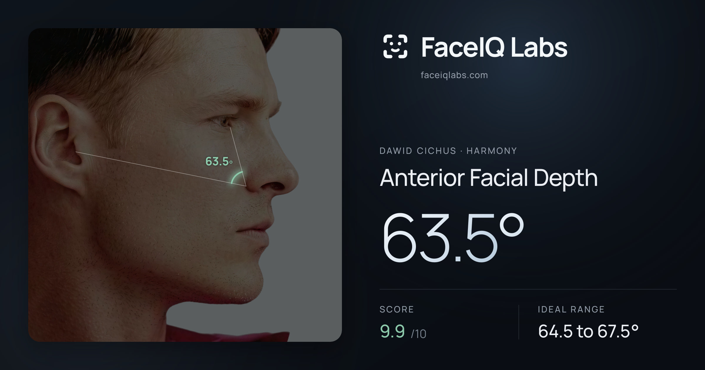 Dawid Cichus Anterior Facial Depth: 63.5°, drawn on the photo