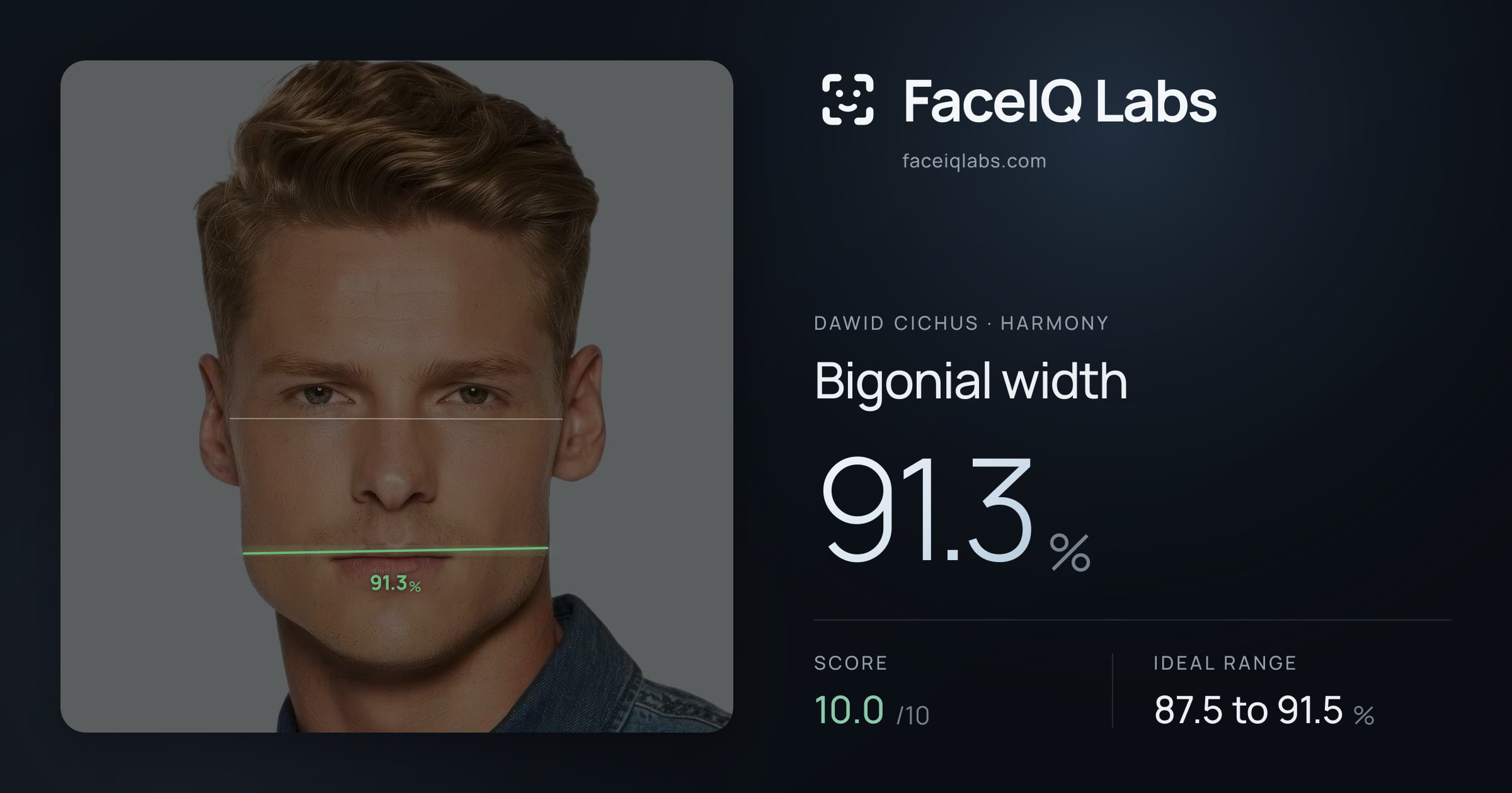 Dawid Cichus Bigonial width: 91.3%, drawn on the photo