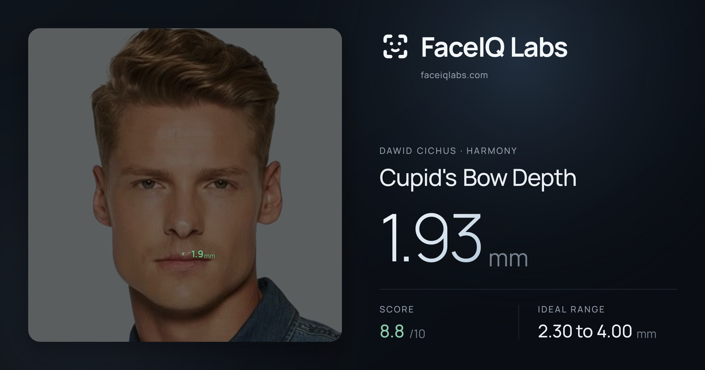 Dawid Cichus Cupid's Bow Depth: 1.93mm, drawn on the photo