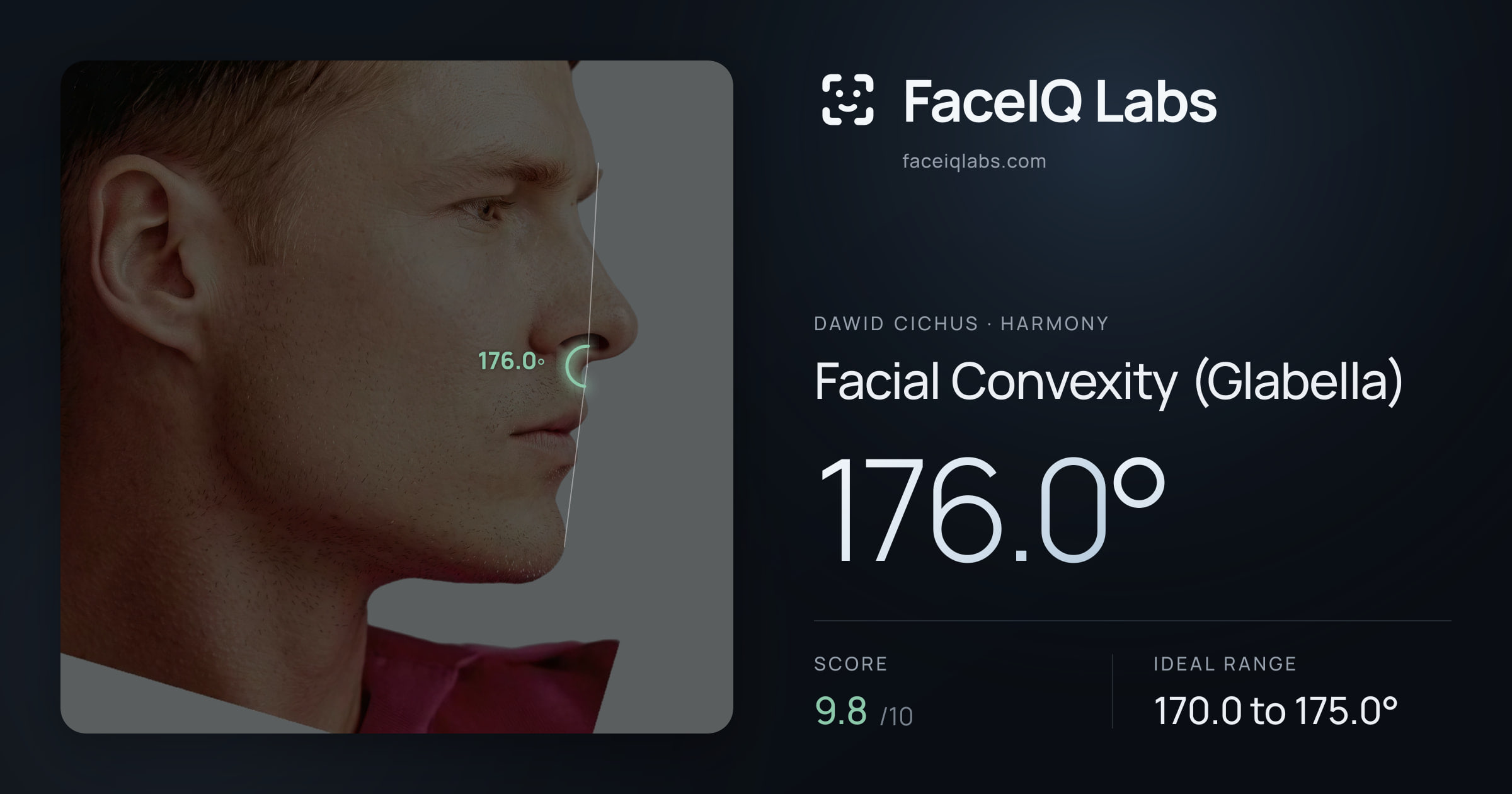 Dawid Cichus Facial Convexity (Glabella): 176.0°, drawn on the photo