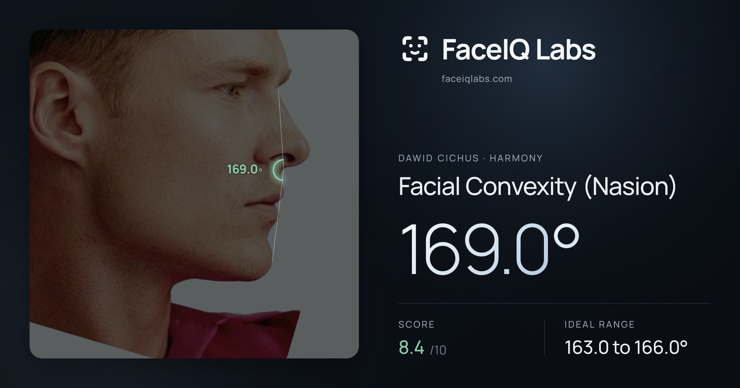 Dawid Cichus Facial Convexity (Nasion): 169.0°, drawn on the photo