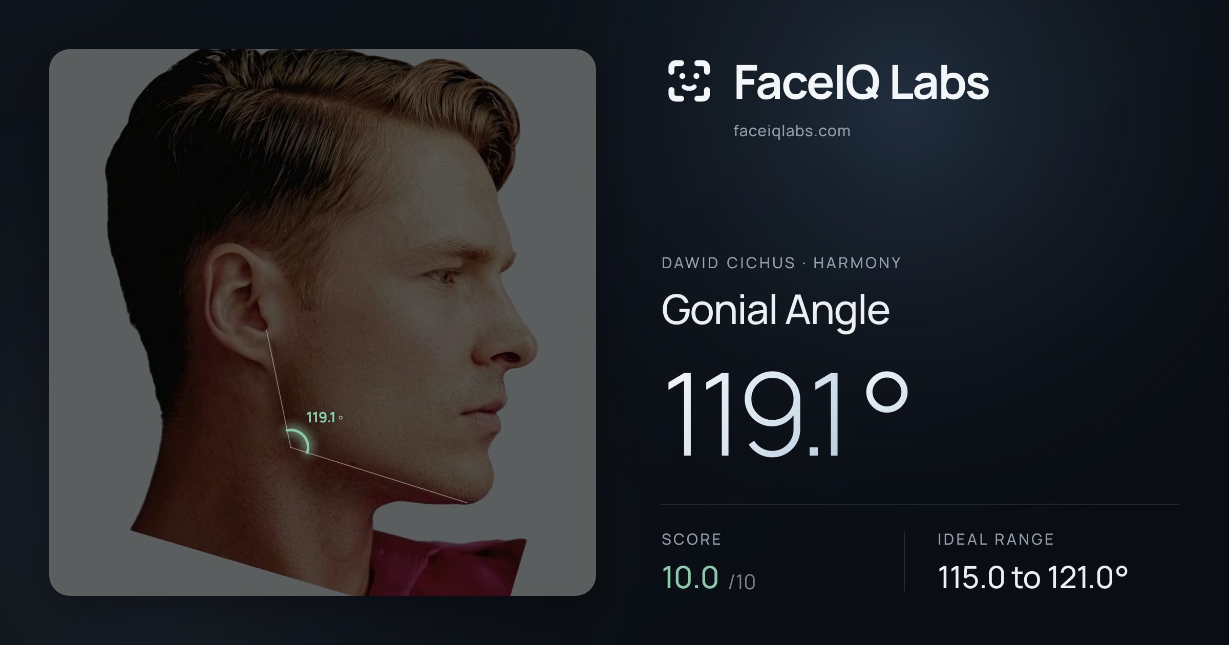 Dawid Cichus Gonial Angle: 119.1°, drawn on the photo