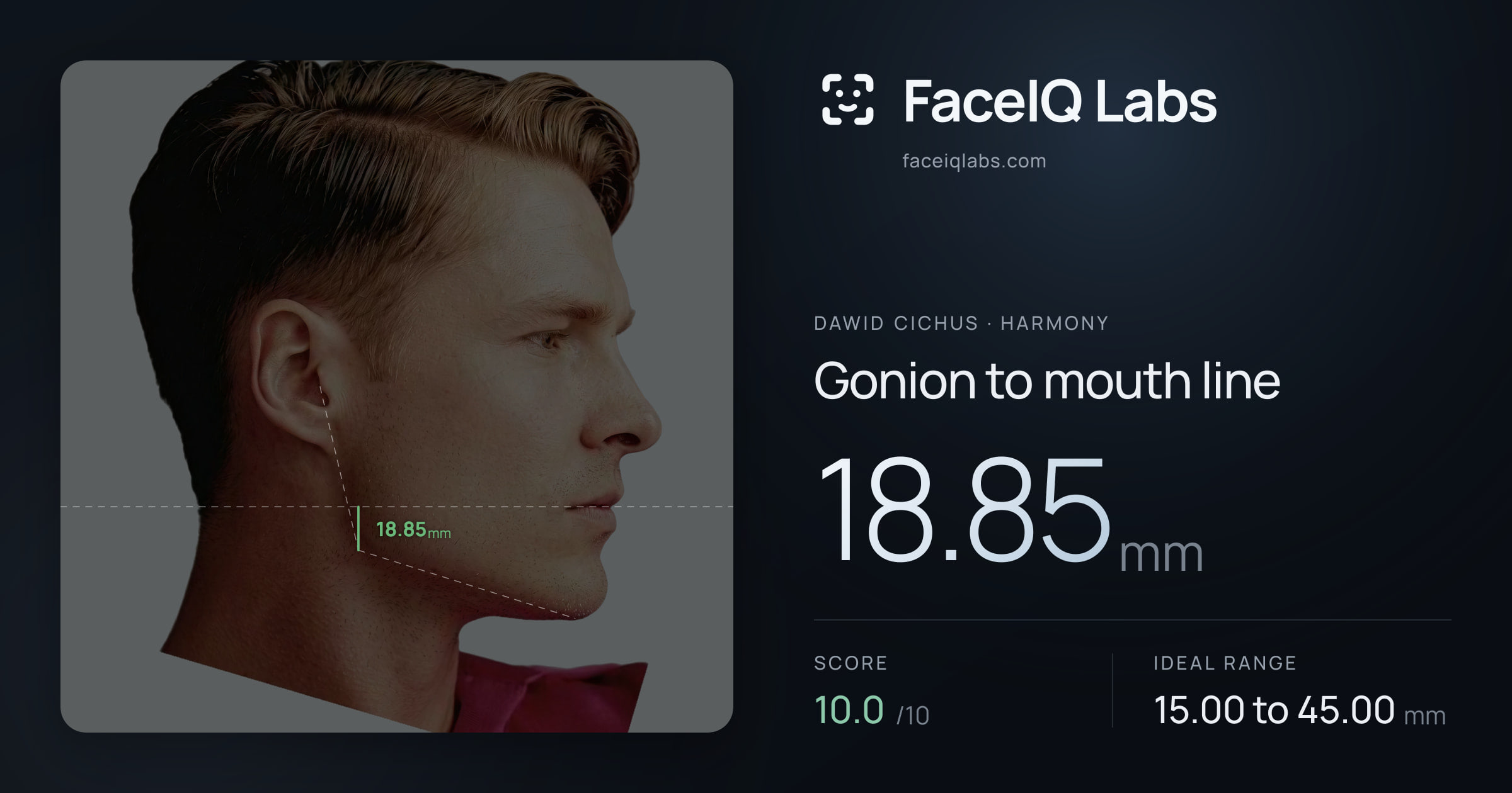 Dawid Cichus Gonion to mouth line: 18.85mm, drawn on the photo