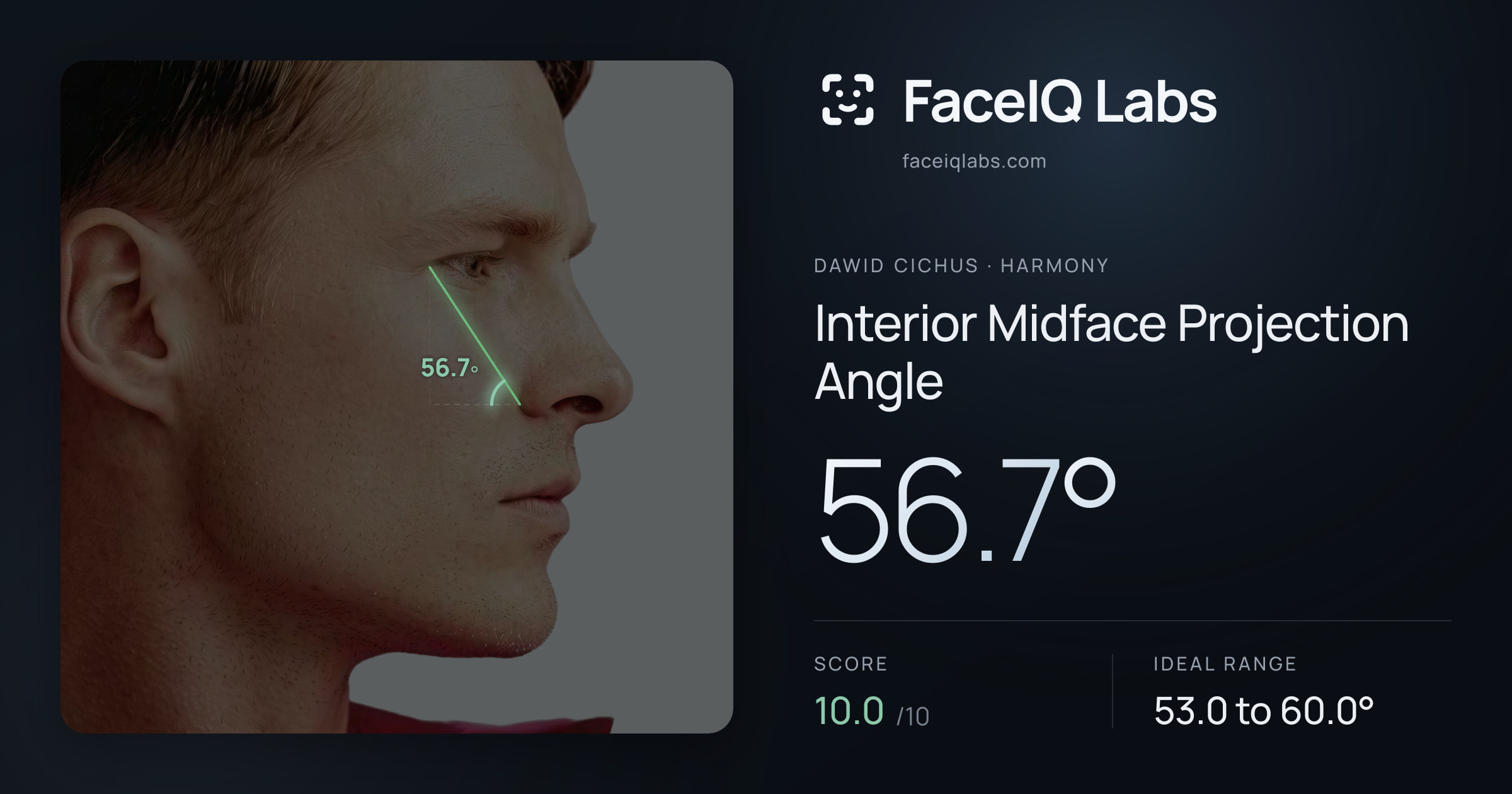 Dawid Cichus Interior Midface Projection Angle: 56.7°, drawn on the photo
