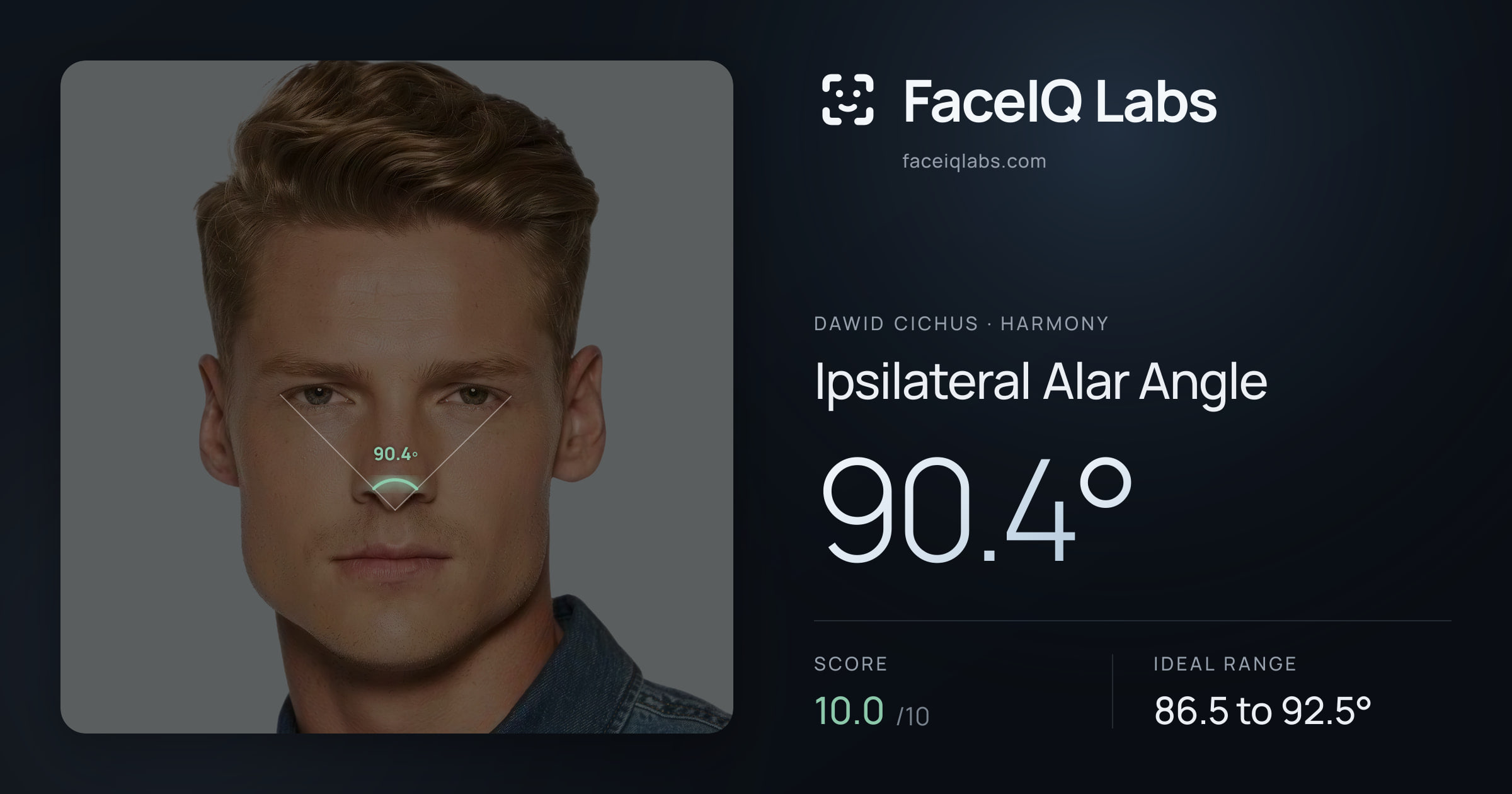 Dawid Cichus Ipsilateral Alar Angle: 90.4°, drawn on the photo