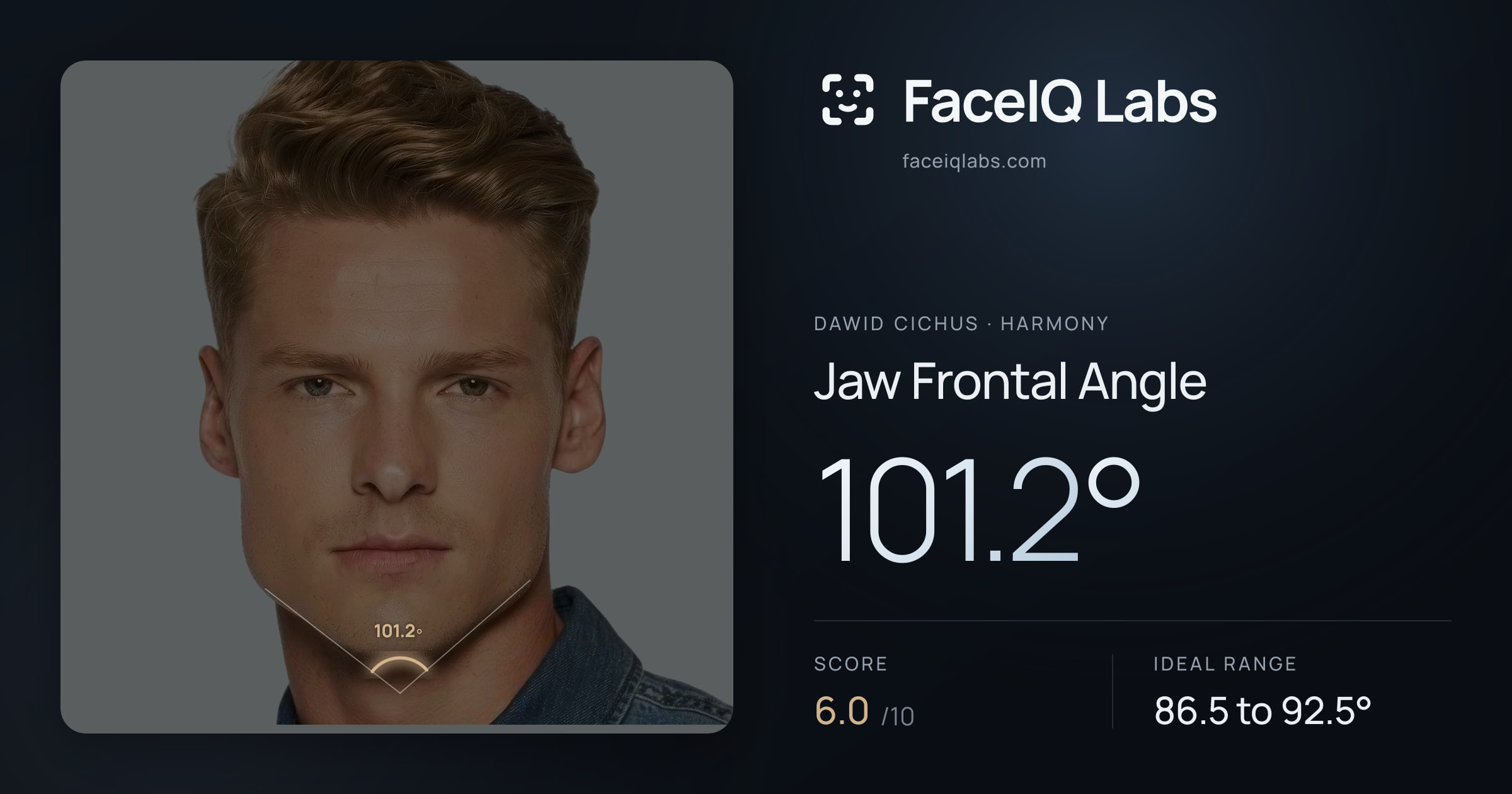 Dawid Cichus Jaw Frontal Angle: 101.2°, drawn on the photo