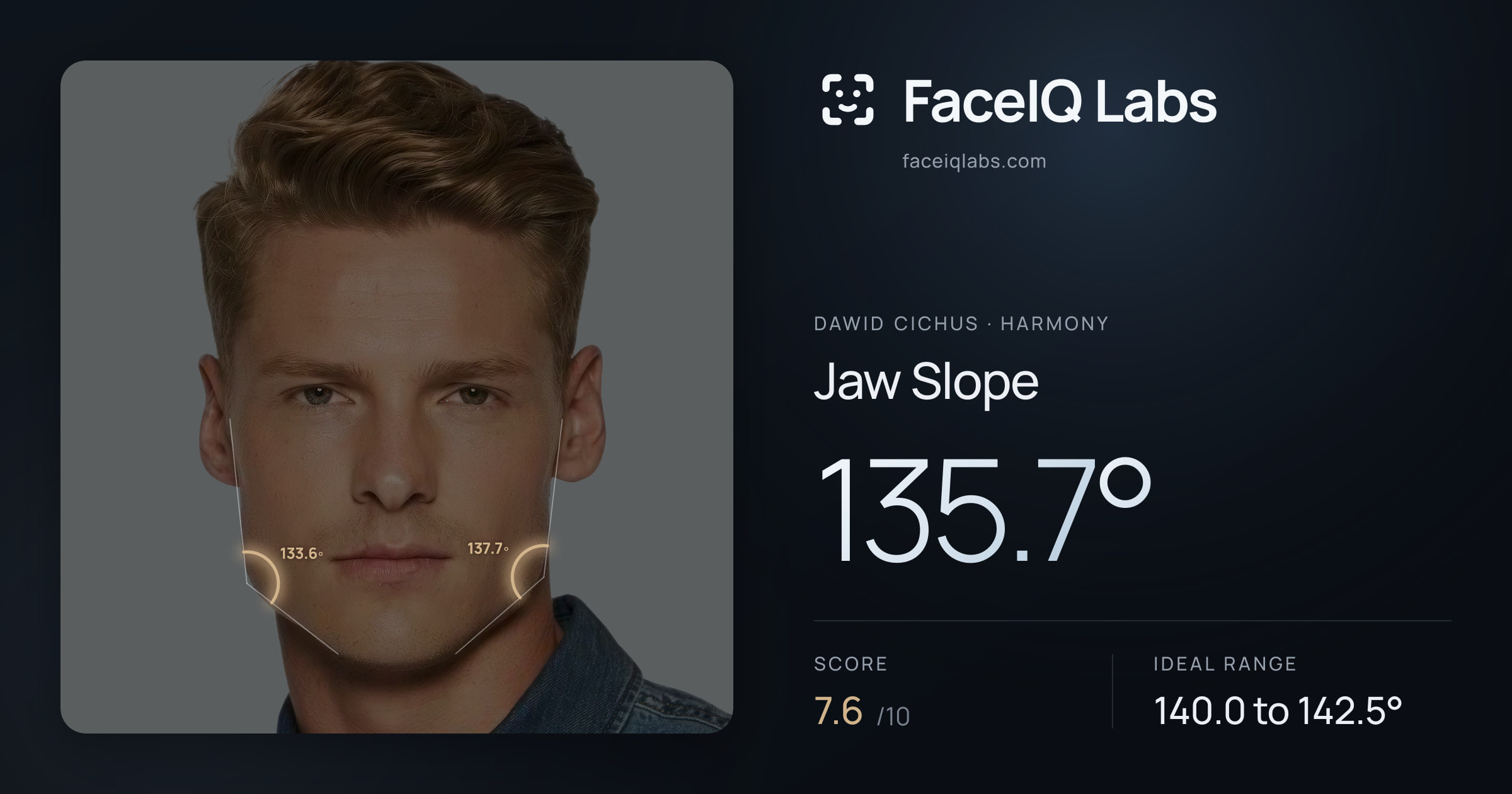 Dawid Cichus Jaw Slope: 135.7°, drawn on the photo