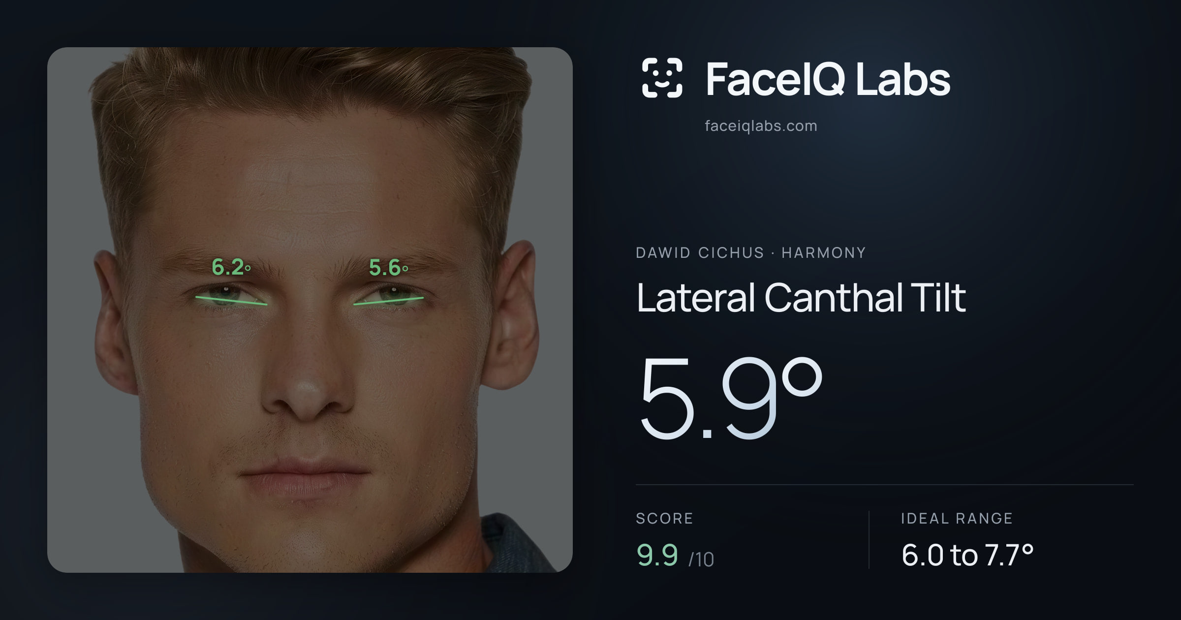 Dawid Cichus Lateral Canthal Tilt: 5.9°, drawn on the photo