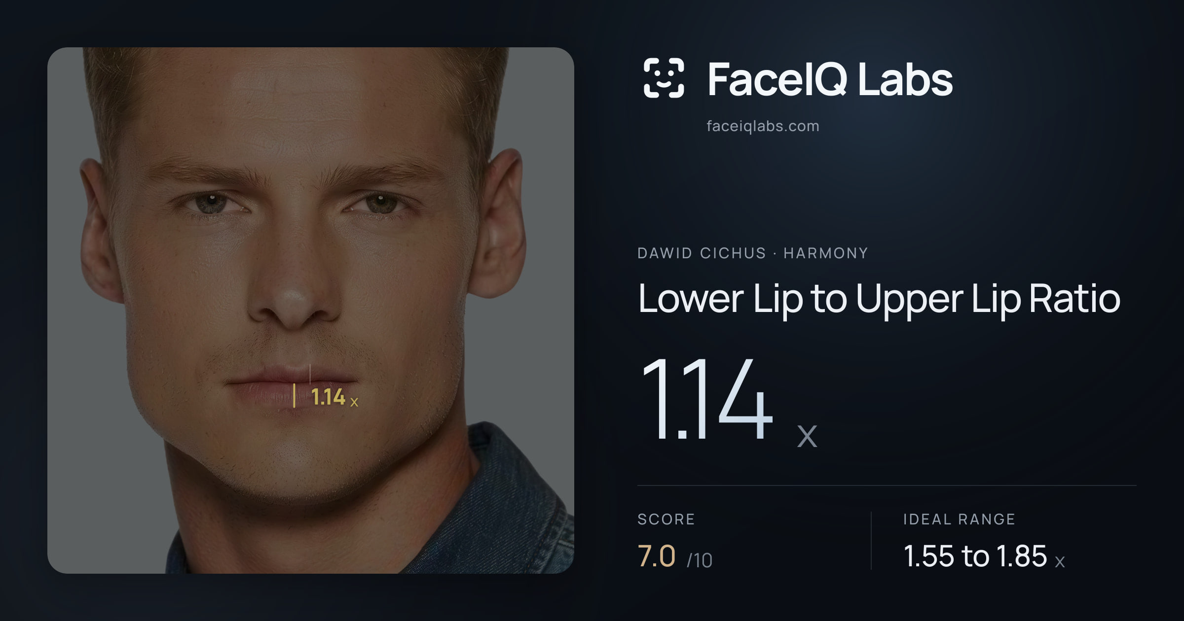 Dawid Cichus Lower Lip to Upper Lip Ratio: 1.14x, drawn on the photo
