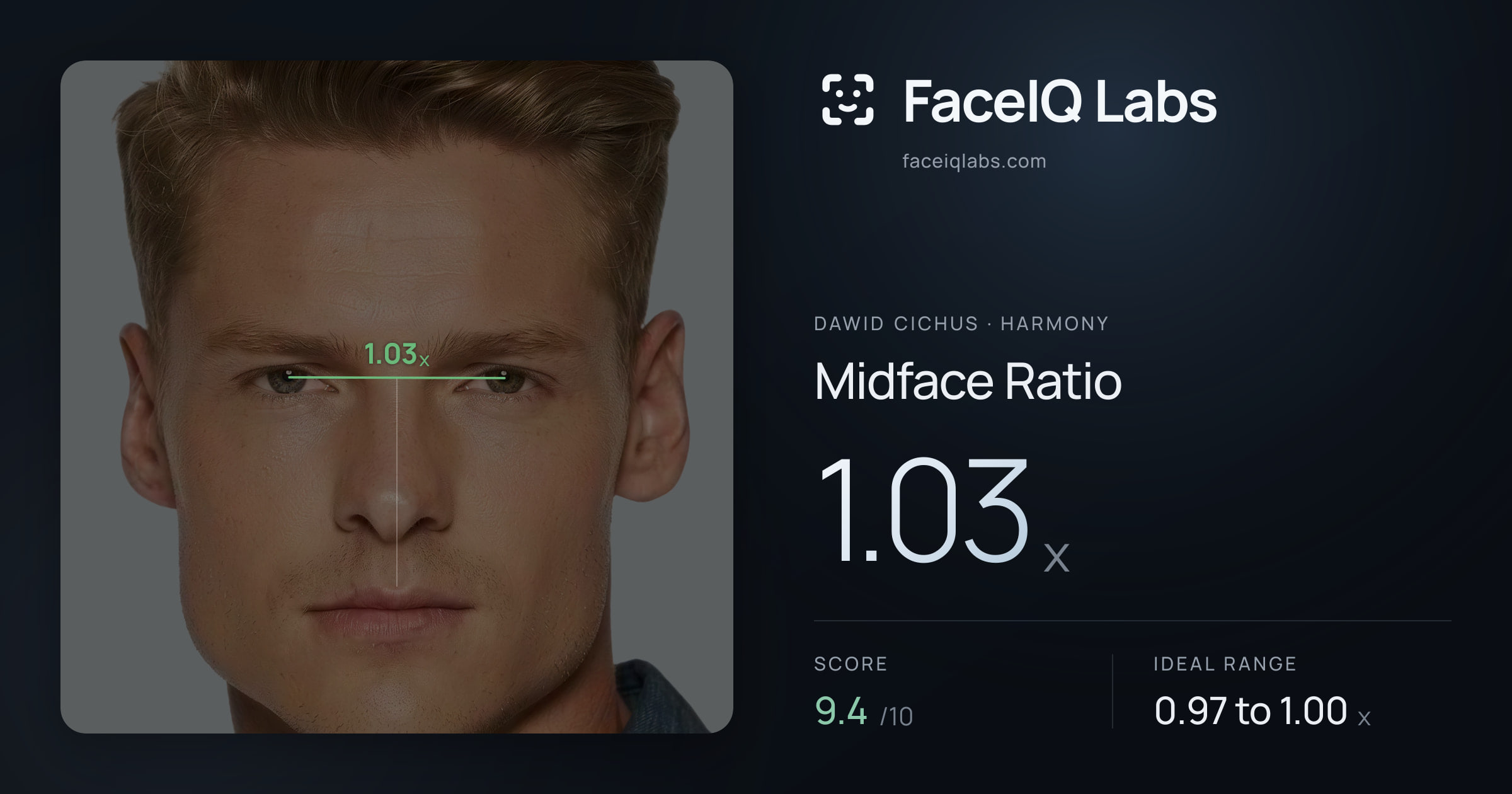 Dawid Cichus Midface Ratio: 1.03x, drawn on the photo