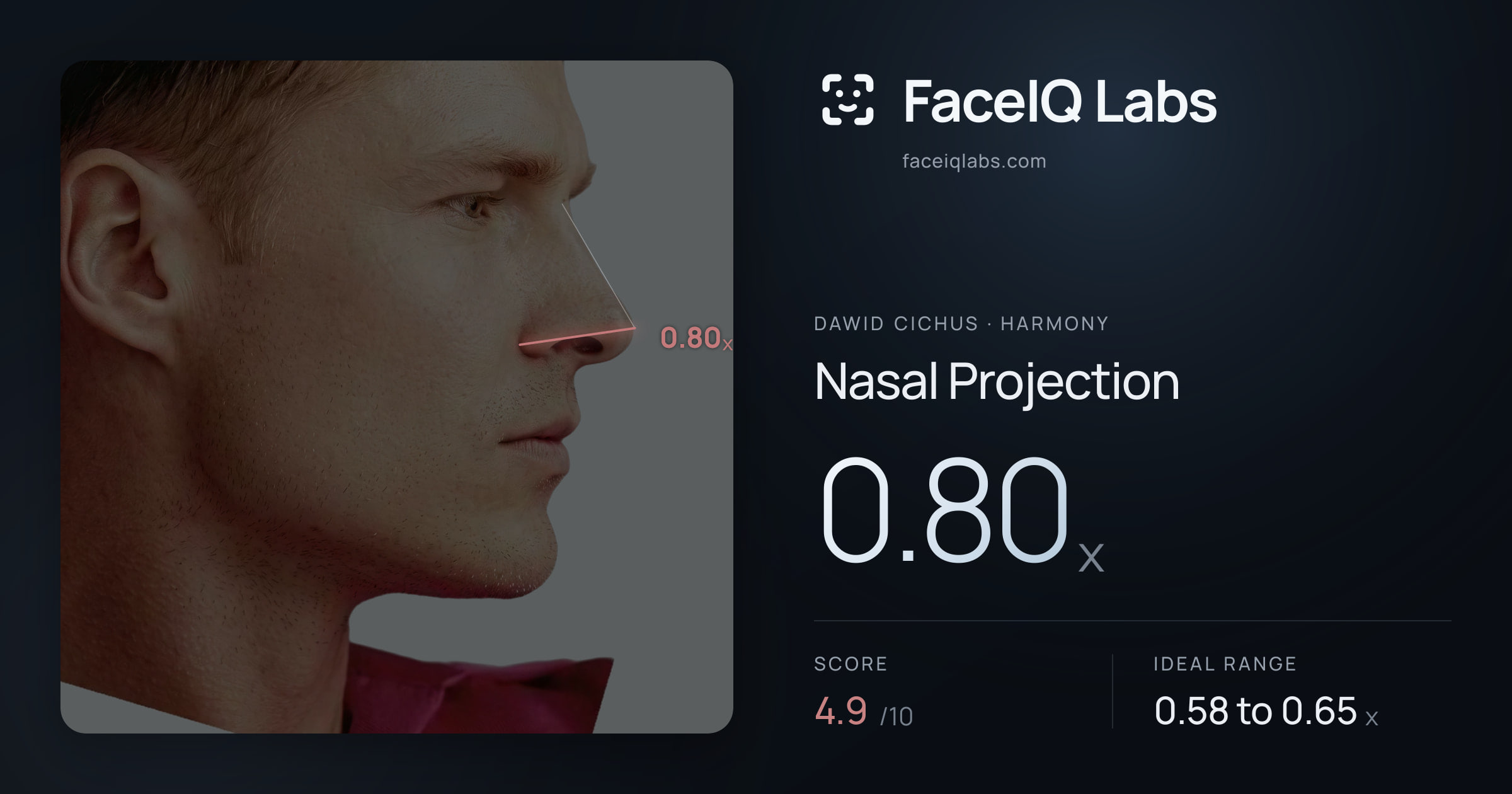 Dawid Cichus Nasal Projection: 0.80x, drawn on the photo