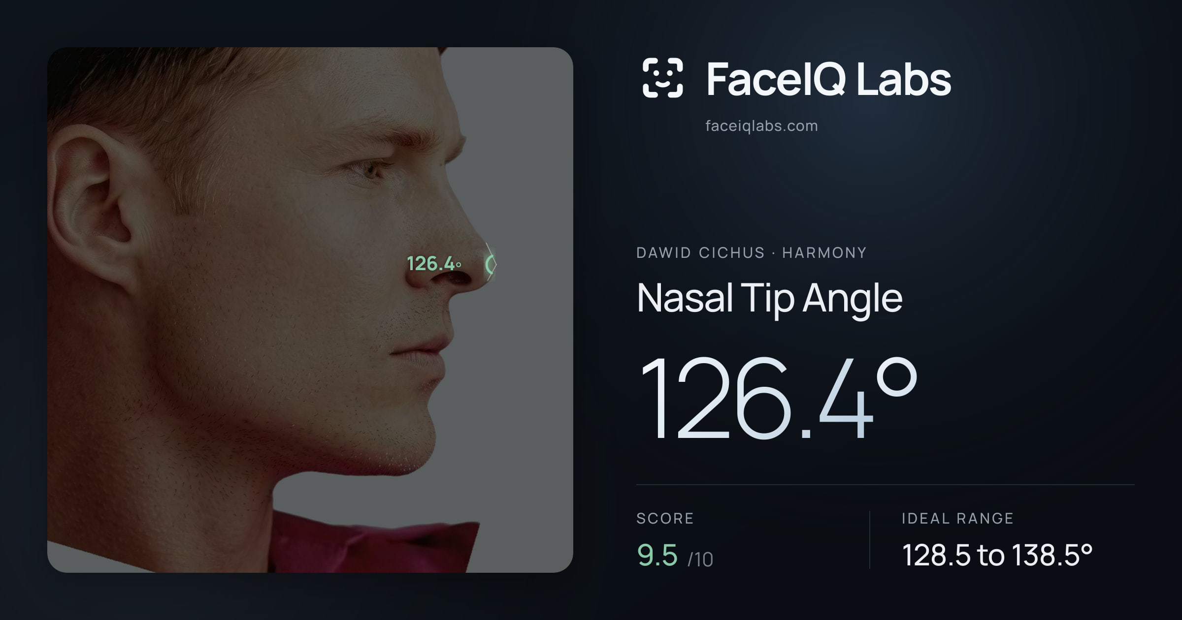 Dawid Cichus Nasal Tip Angle: 126.4°, drawn on the photo