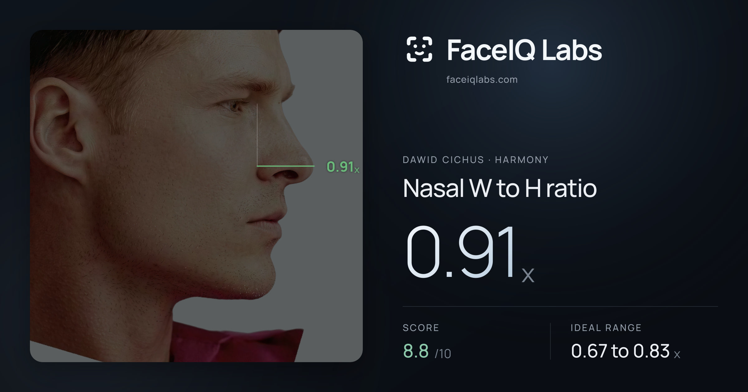 Dawid Cichus Nasal W to H ratio: 0.91x, drawn on the photo