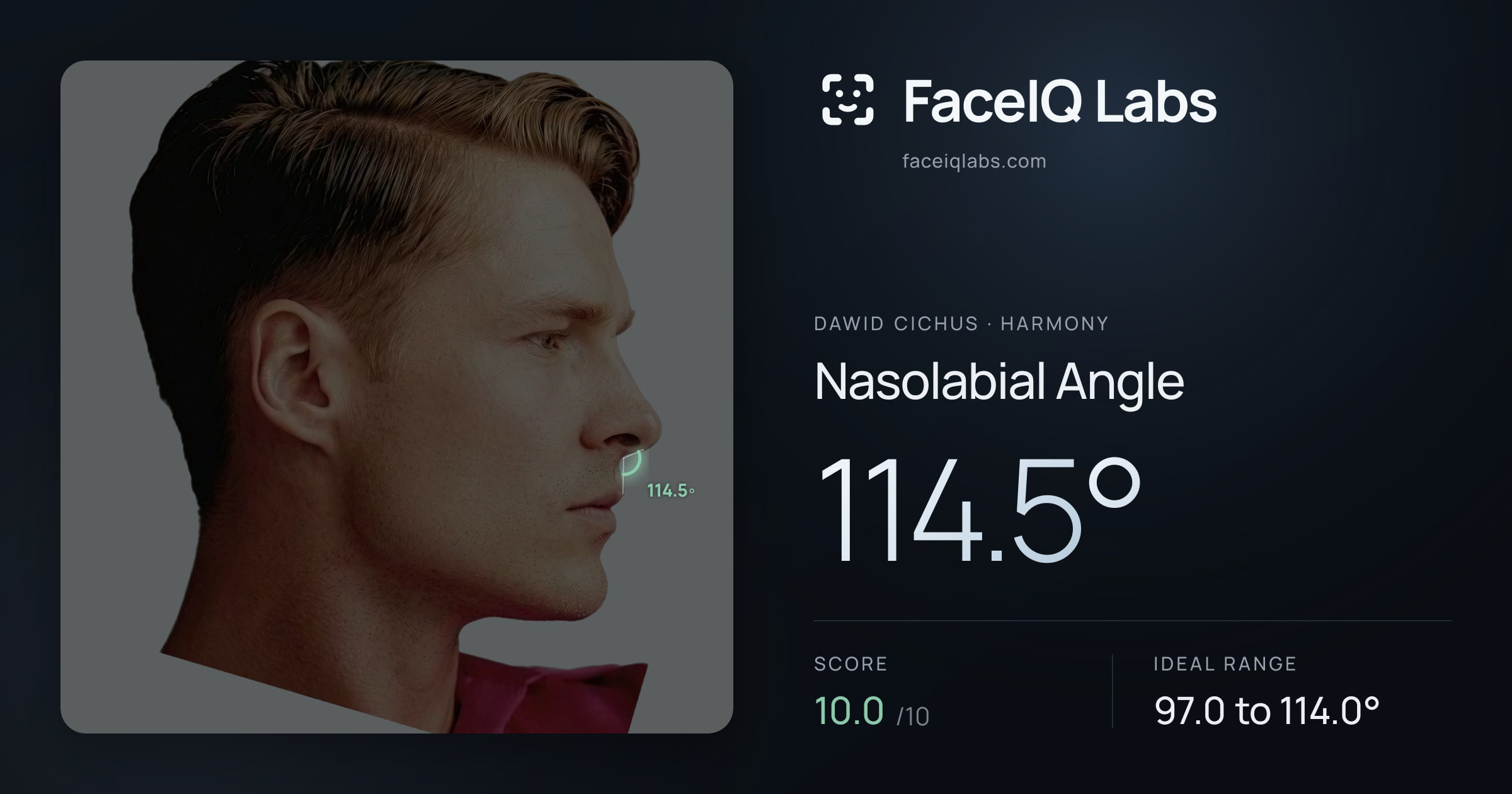 Dawid Cichus Nasolabial Angle: 114.5°, drawn on the photo