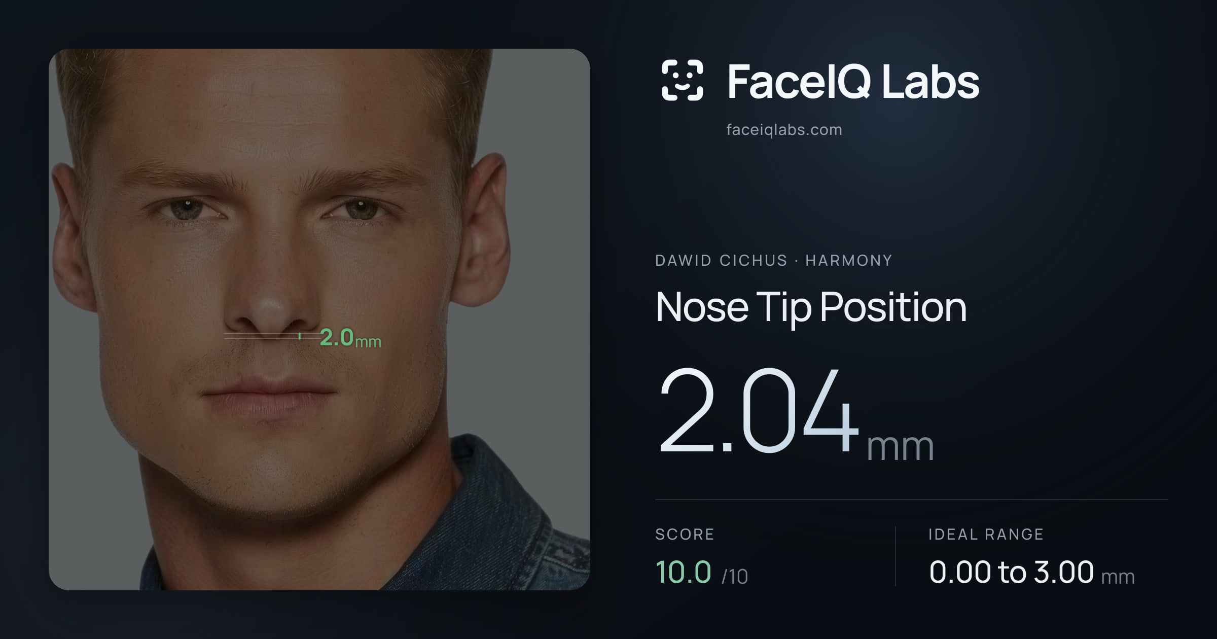 Dawid Cichus Nose Tip Position: 2.04mm, drawn on the photo
