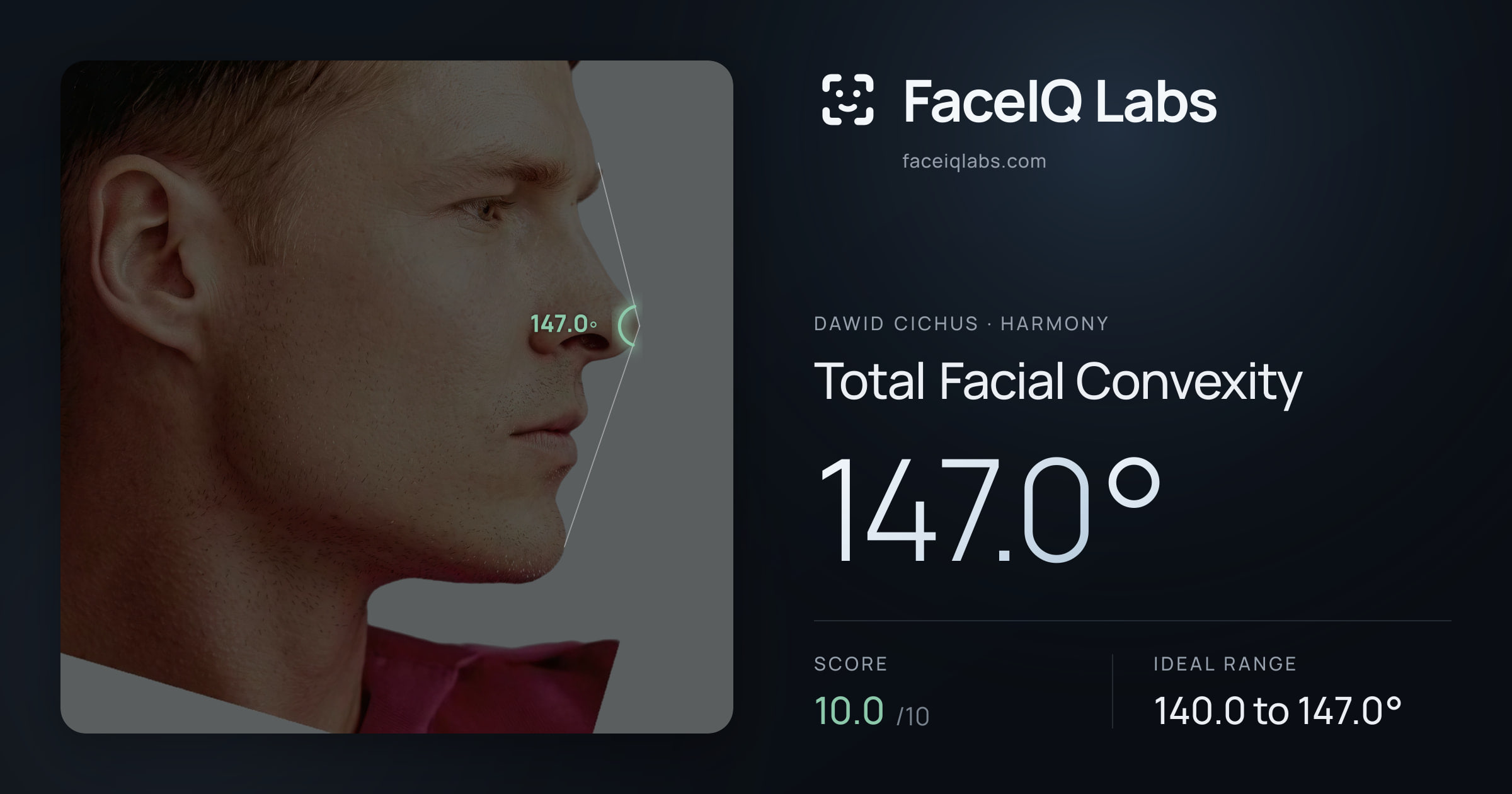 Dawid Cichus Total Facial Convexity: 147.0°, drawn on the photo