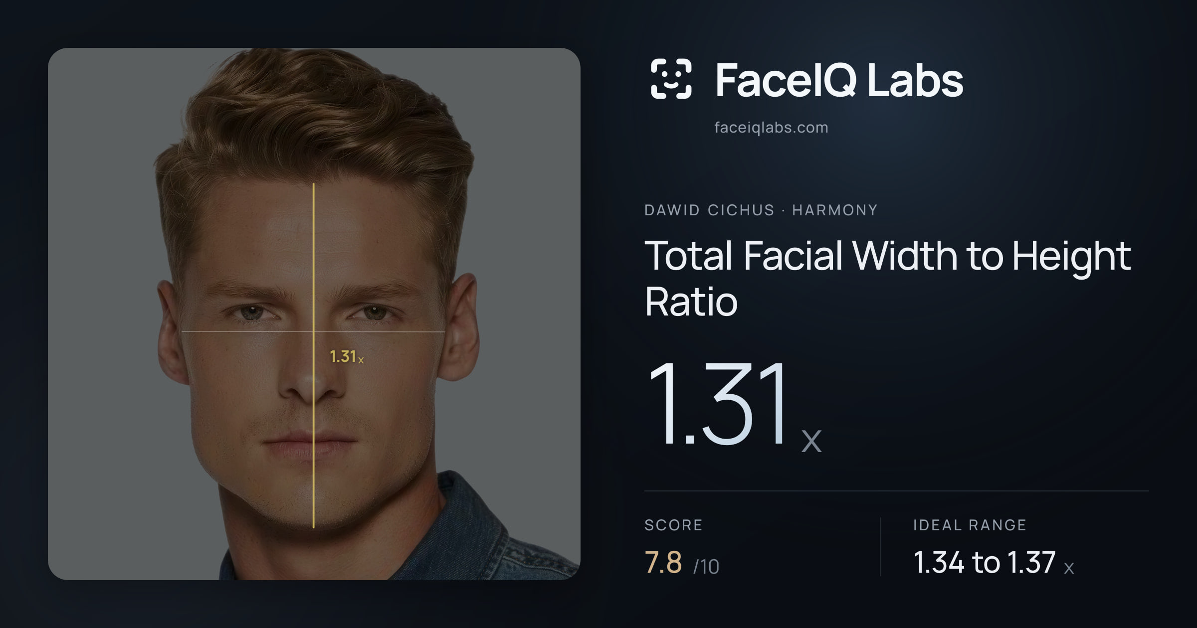 Dawid Cichus Total Facial Width to Height Ratio: 1.31x, drawn on the photo