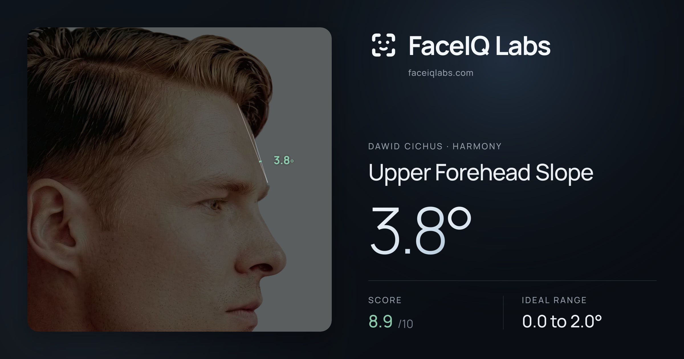 Dawid Cichus Upper Forehead Slope: 3.8°, drawn on the photo