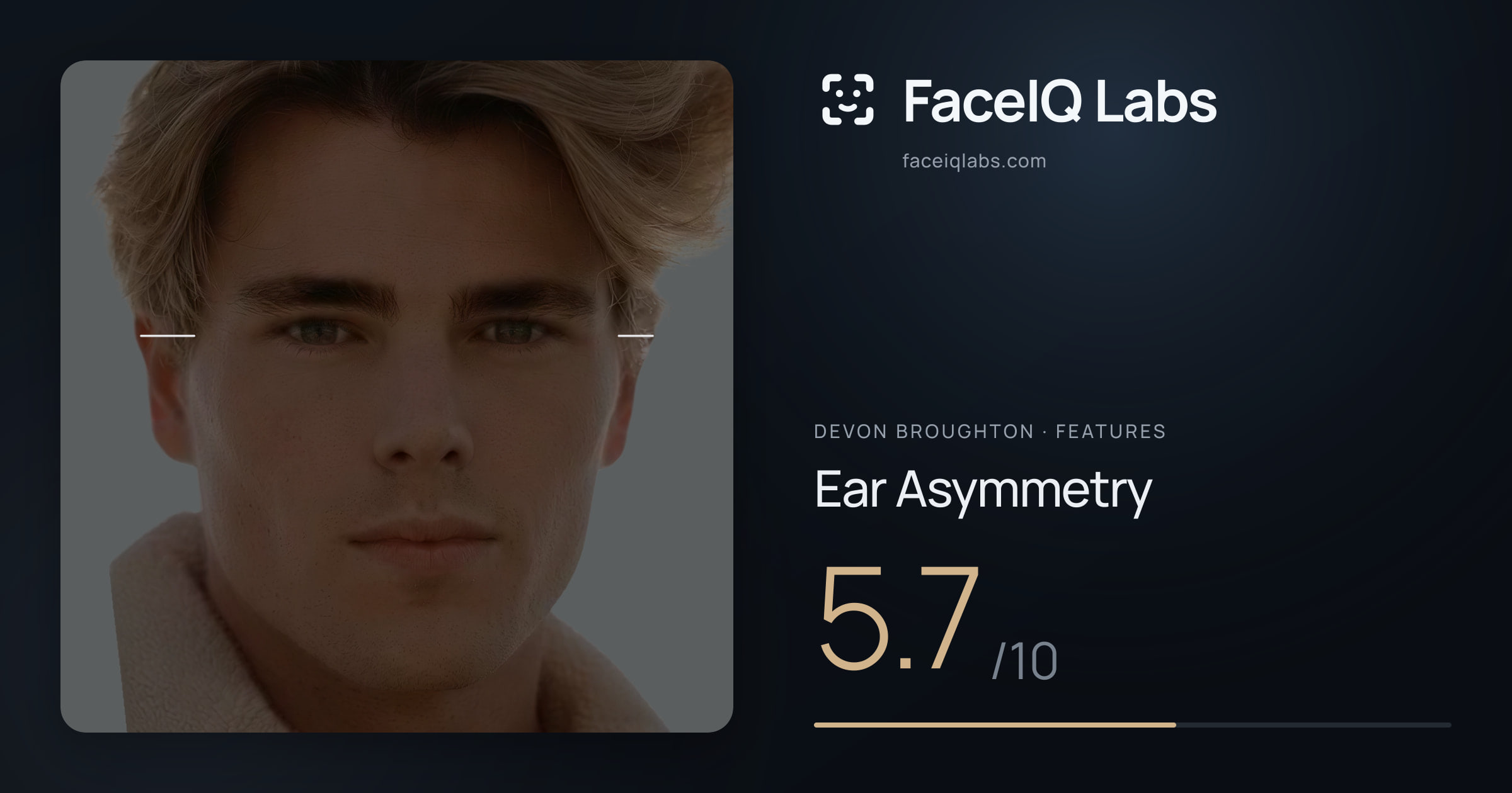 Devon Broughton Ear Asymmetry: 5.7/10, drawn on the photo