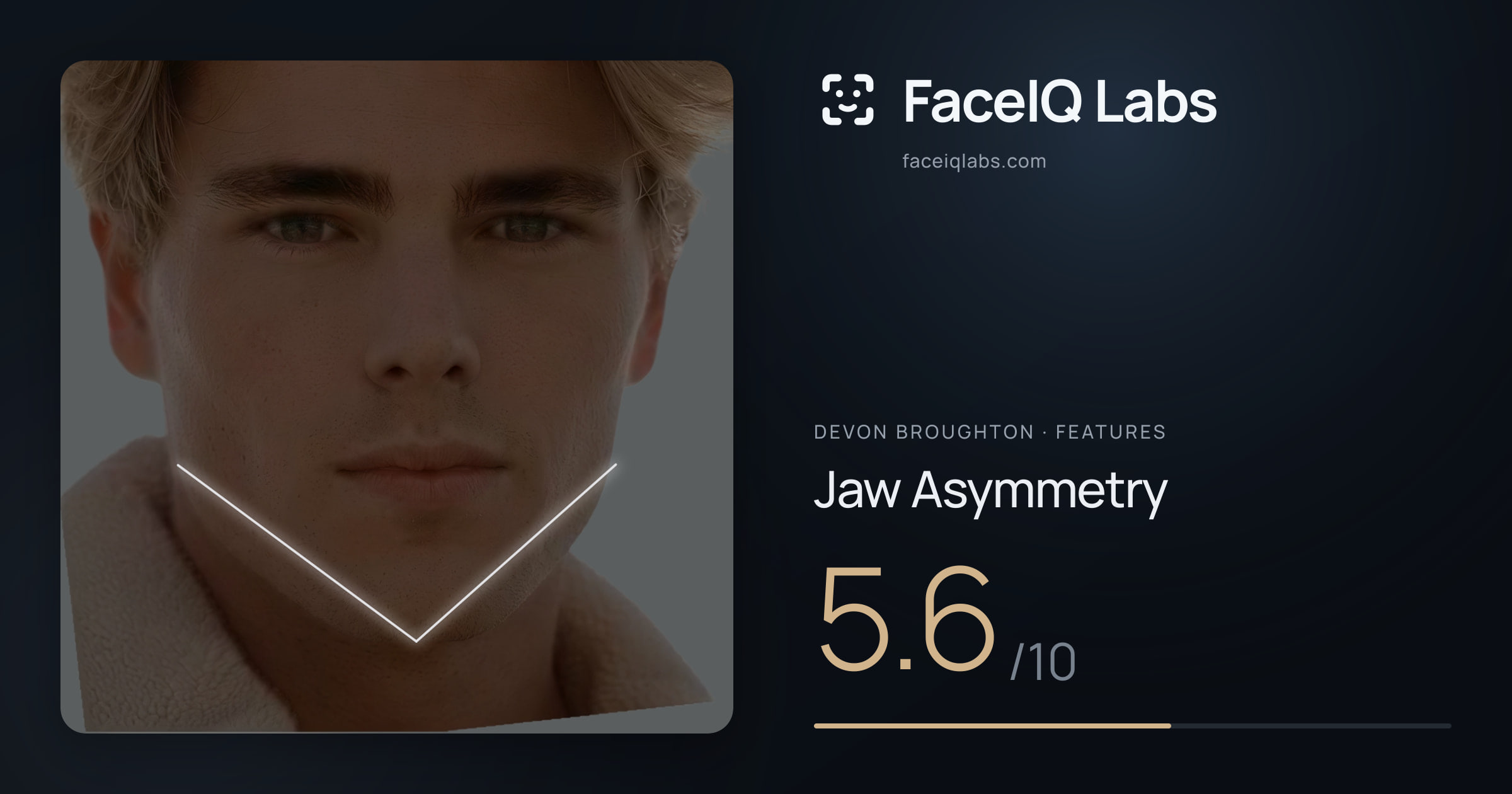 Devon Broughton Jaw Asymmetry: 5.6/10, drawn on the photo