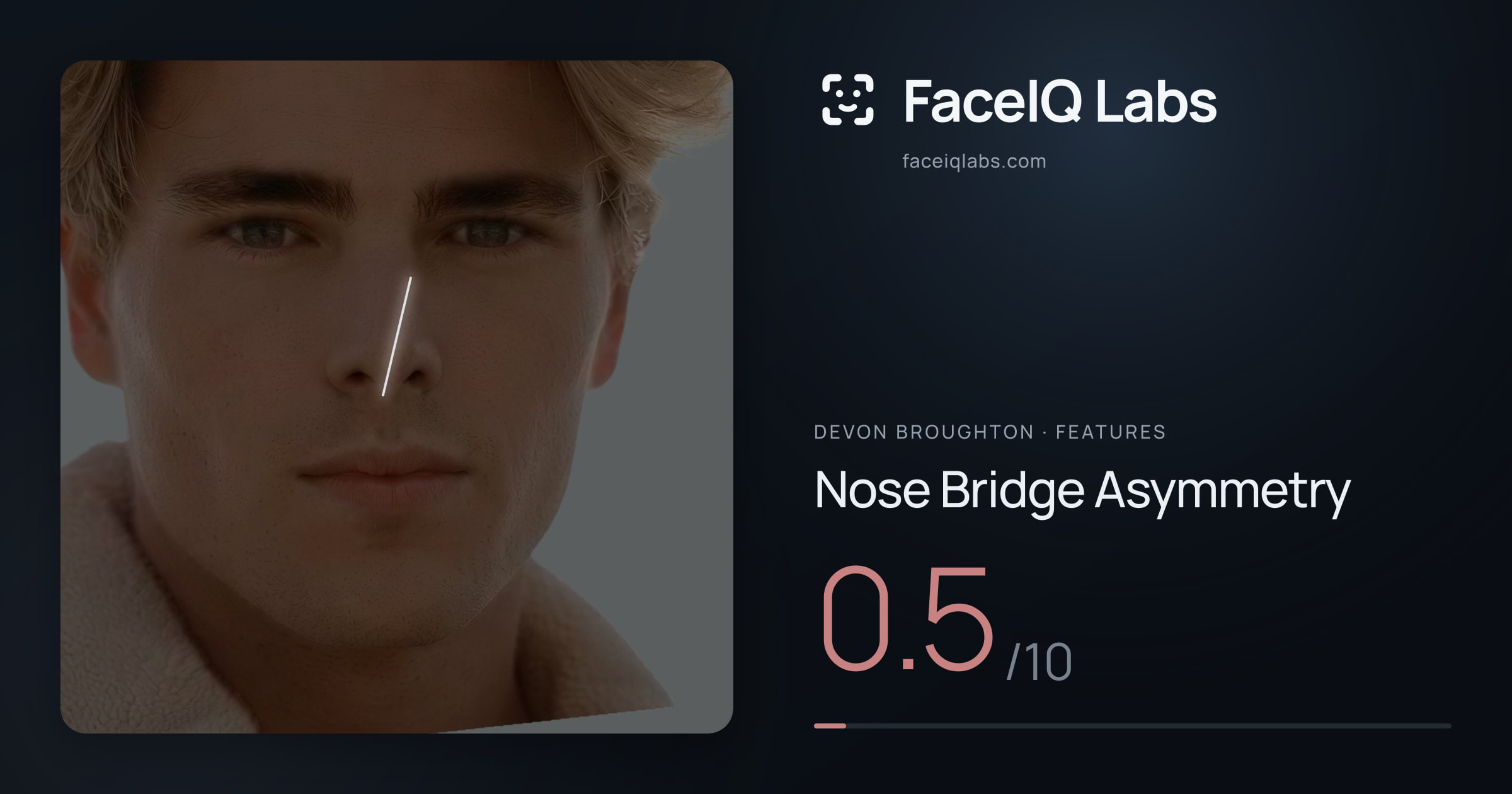 Devon Broughton Nose Bridge Asymmetry: 0.5/10, drawn on the photo