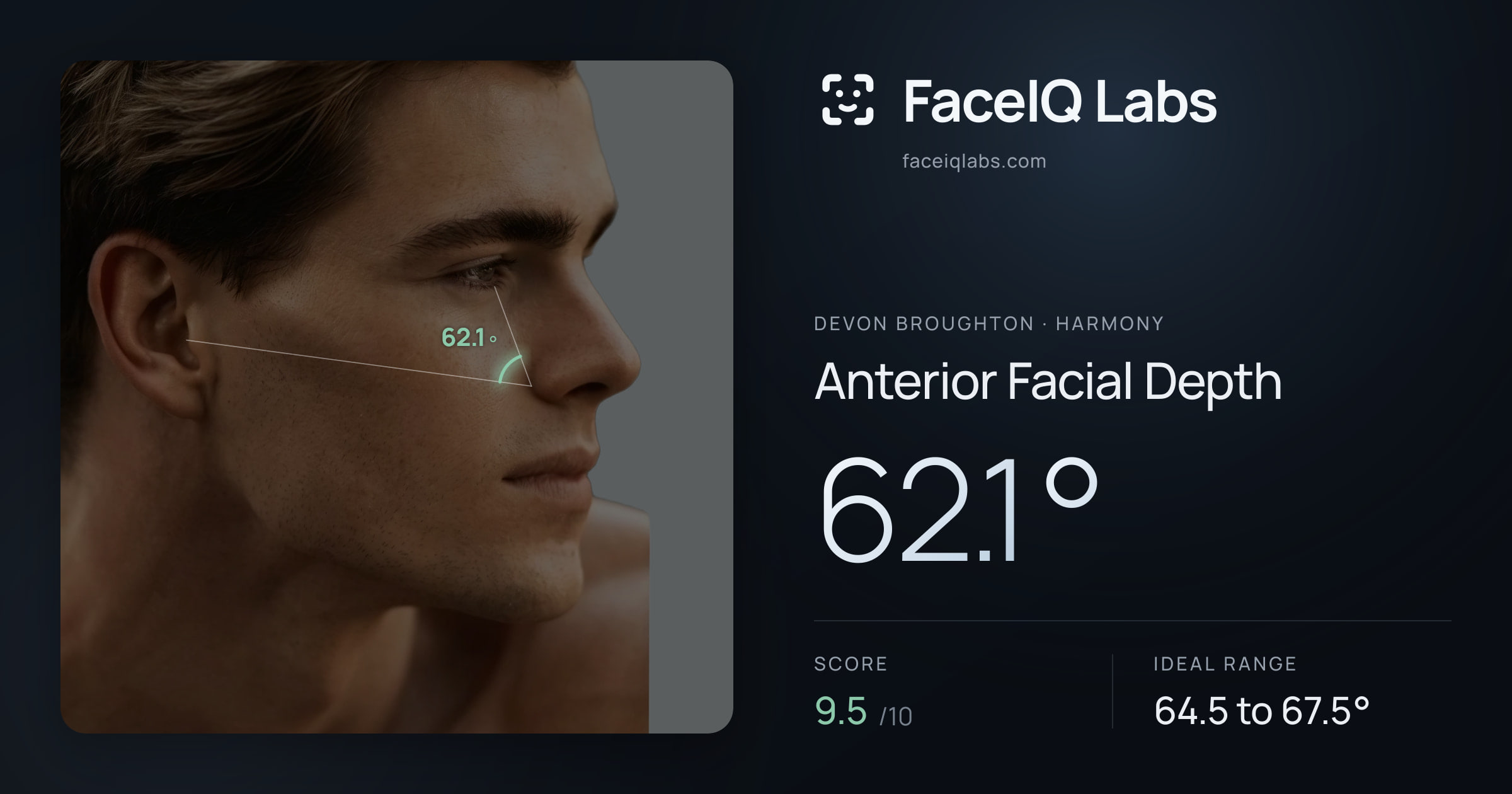Devon Broughton Anterior Facial Depth: 62.1°, drawn on the photo