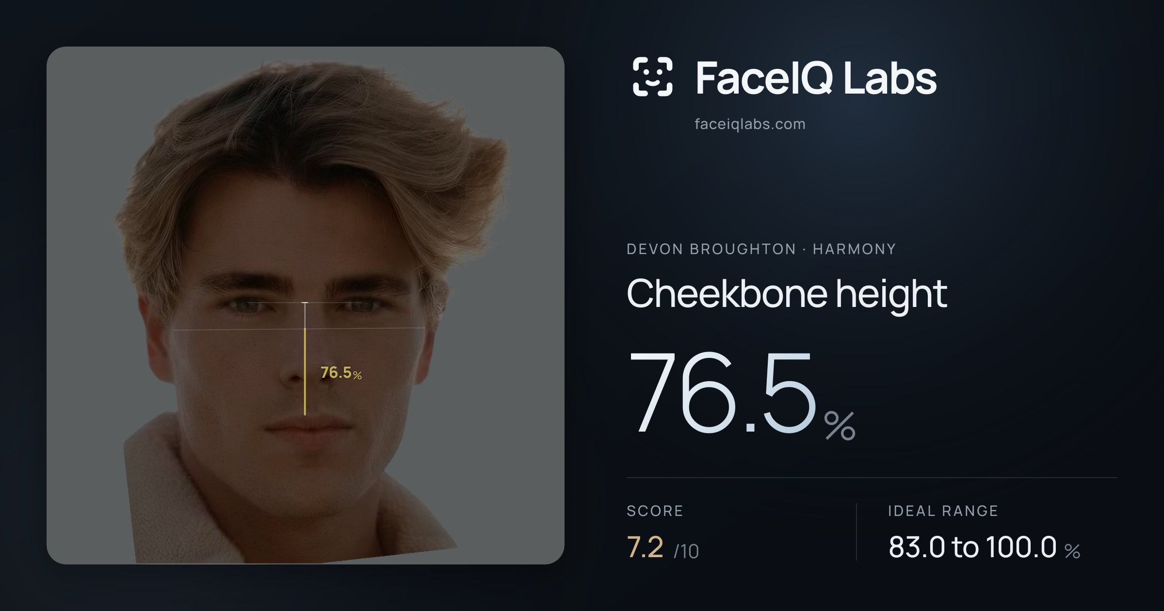 Devon Broughton Cheekbone height: 76.5%, drawn on the photo