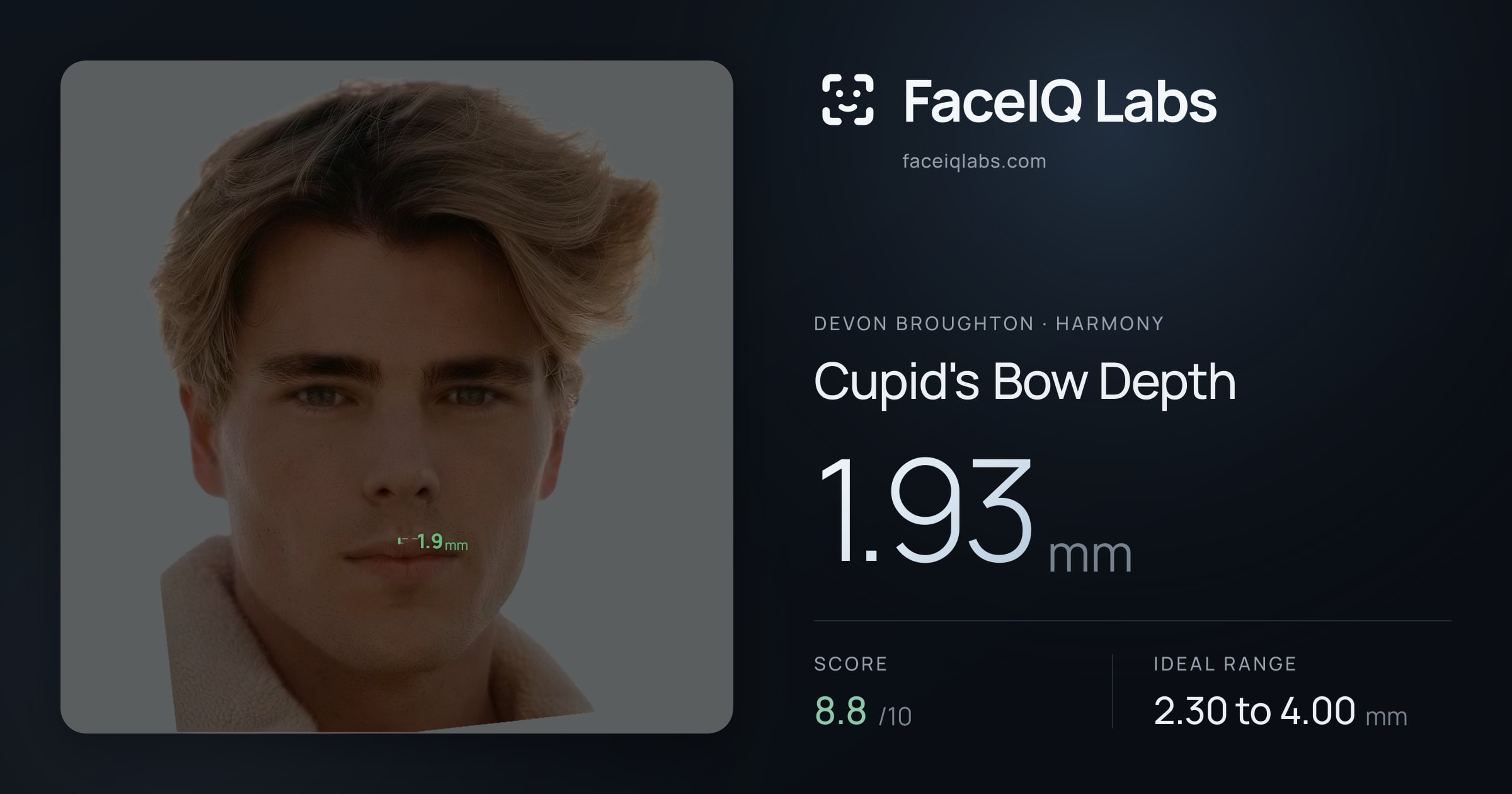 Devon Broughton Cupid's Bow Depth: 1.93mm, drawn on the photo