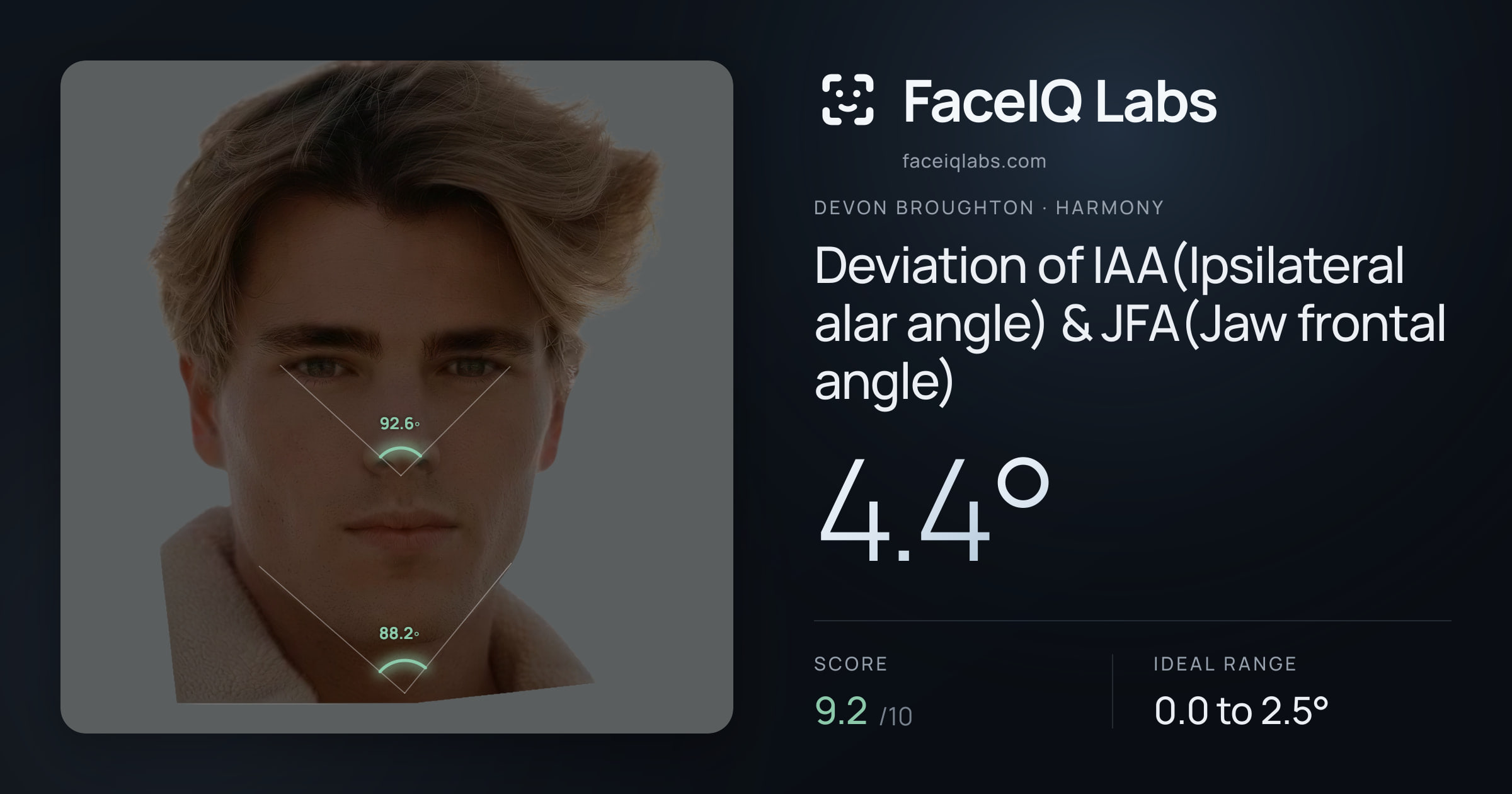 Devon Broughton Deviation of IAA(Ipsilateral alar angle) & JFA(Jaw frontal angle): 4.4°, drawn on the photo