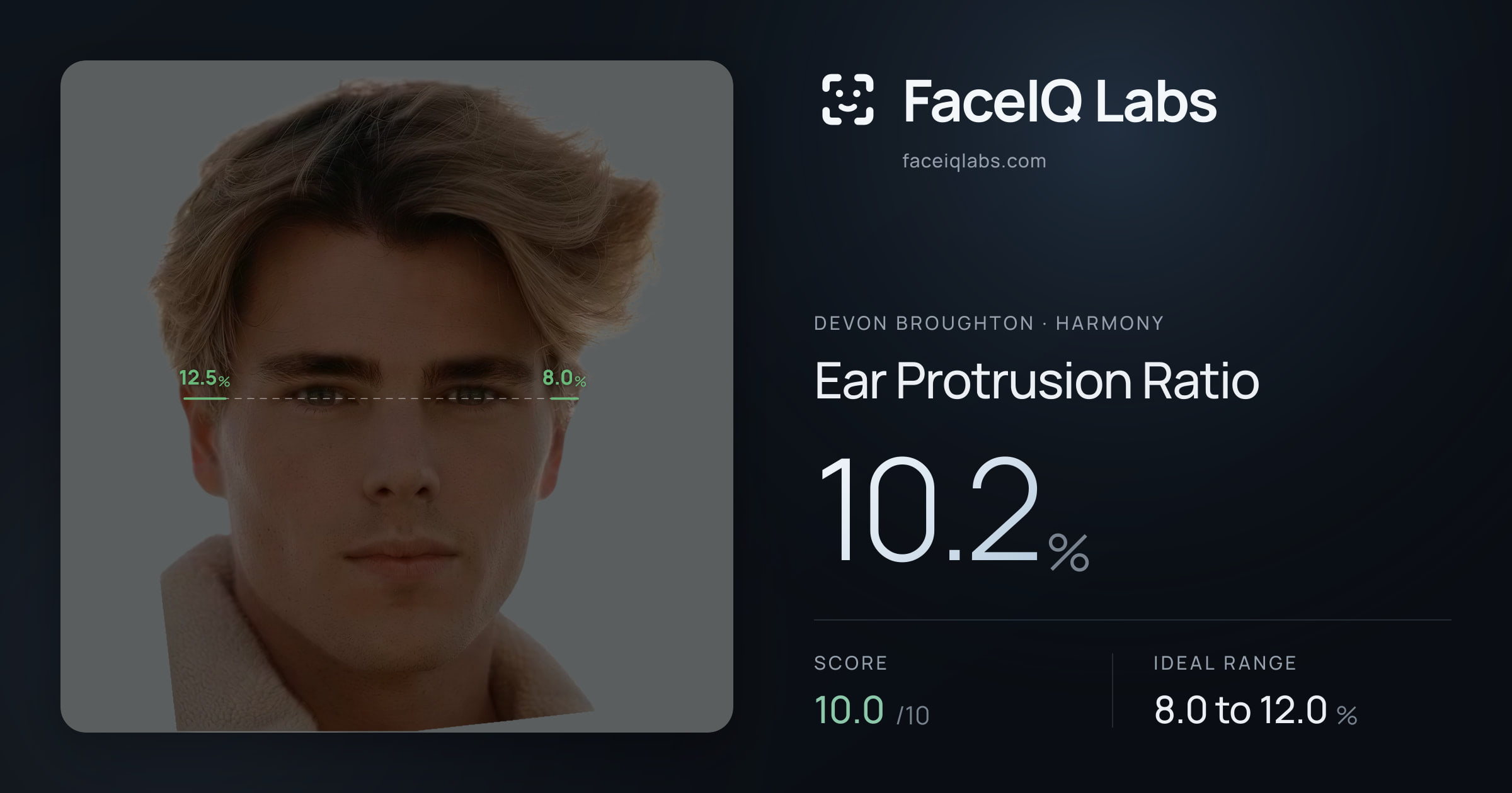 Devon Broughton Ear Protrusion Ratio: 10.2%, drawn on the photo