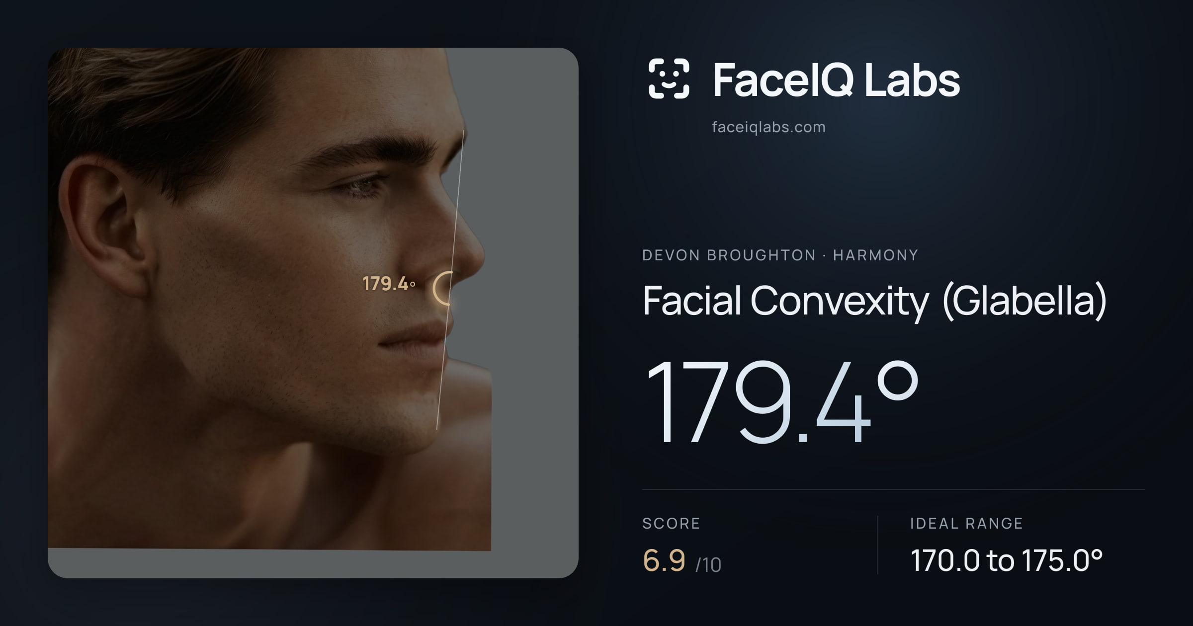 Devon Broughton Facial Convexity (Glabella): 179.4°, drawn on the photo