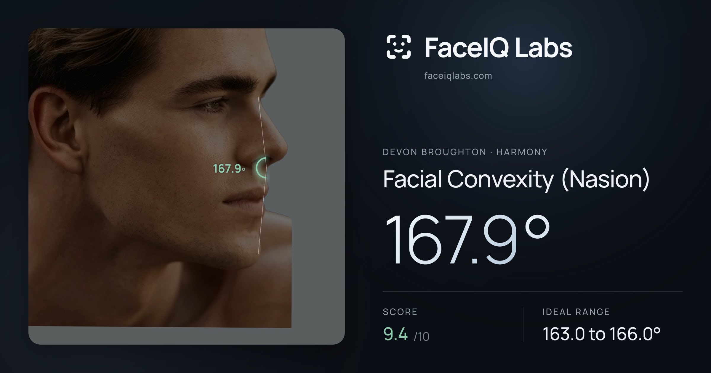 Devon Broughton Facial Convexity (Nasion): 167.9°, drawn on the photo